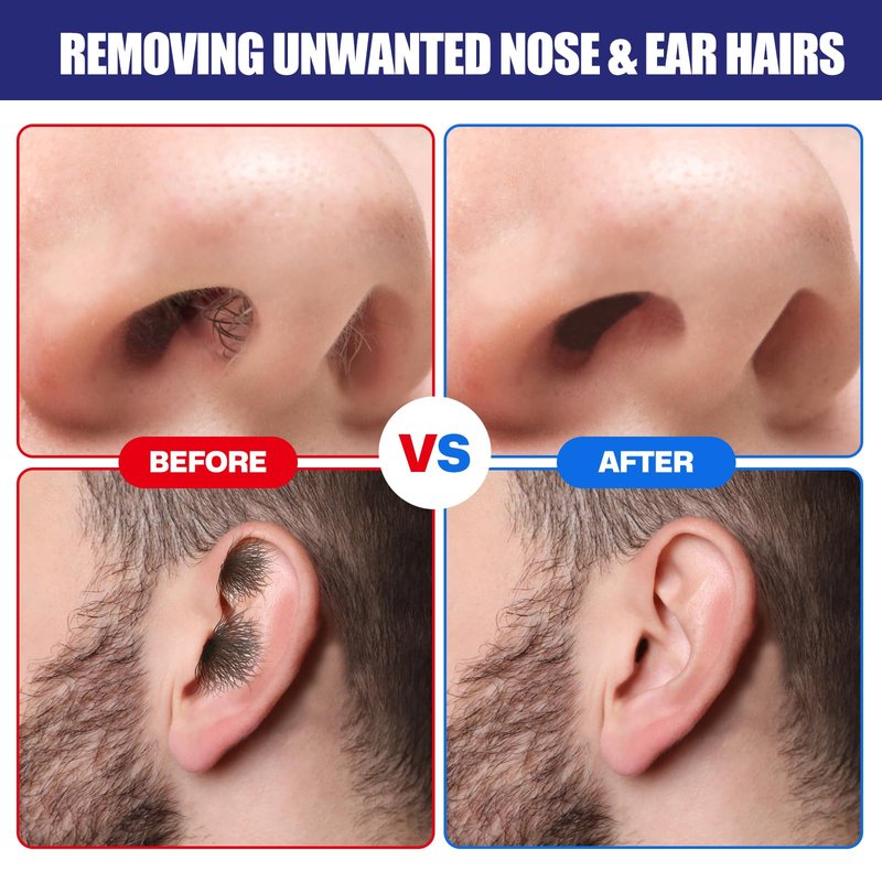 Nose & Ear Waxing Kit - Hypoallergenic Wax + 30 Applicators | Painless Hair Removal for Men & Women | Includes 15 Soothing Balm Wipes & Mustache Guards | Long-Lasting Results (6 Weeks) (120g)