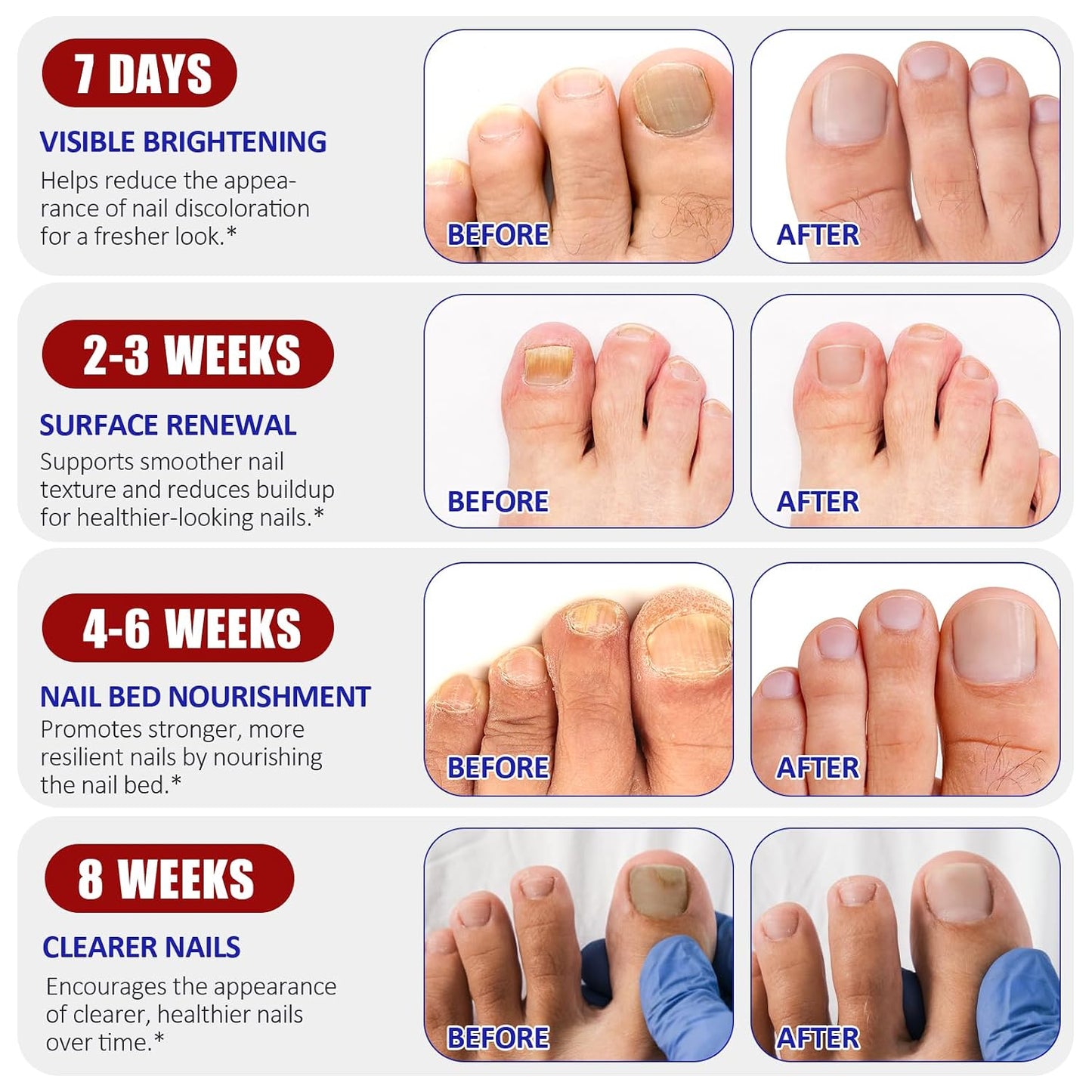 Toenail Care Patches - Overnight Treatment for Dry & Damaged Nails | 2 Pack, Easy Application
