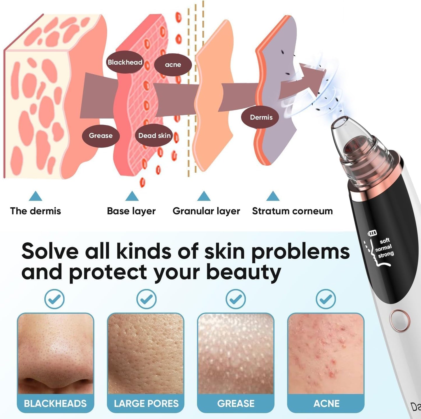 Blackhead Remover Pore Vacuum - Facial Pore Cleanser with 3 Suction Levels & 5 Tips | USB Rechargeable, White