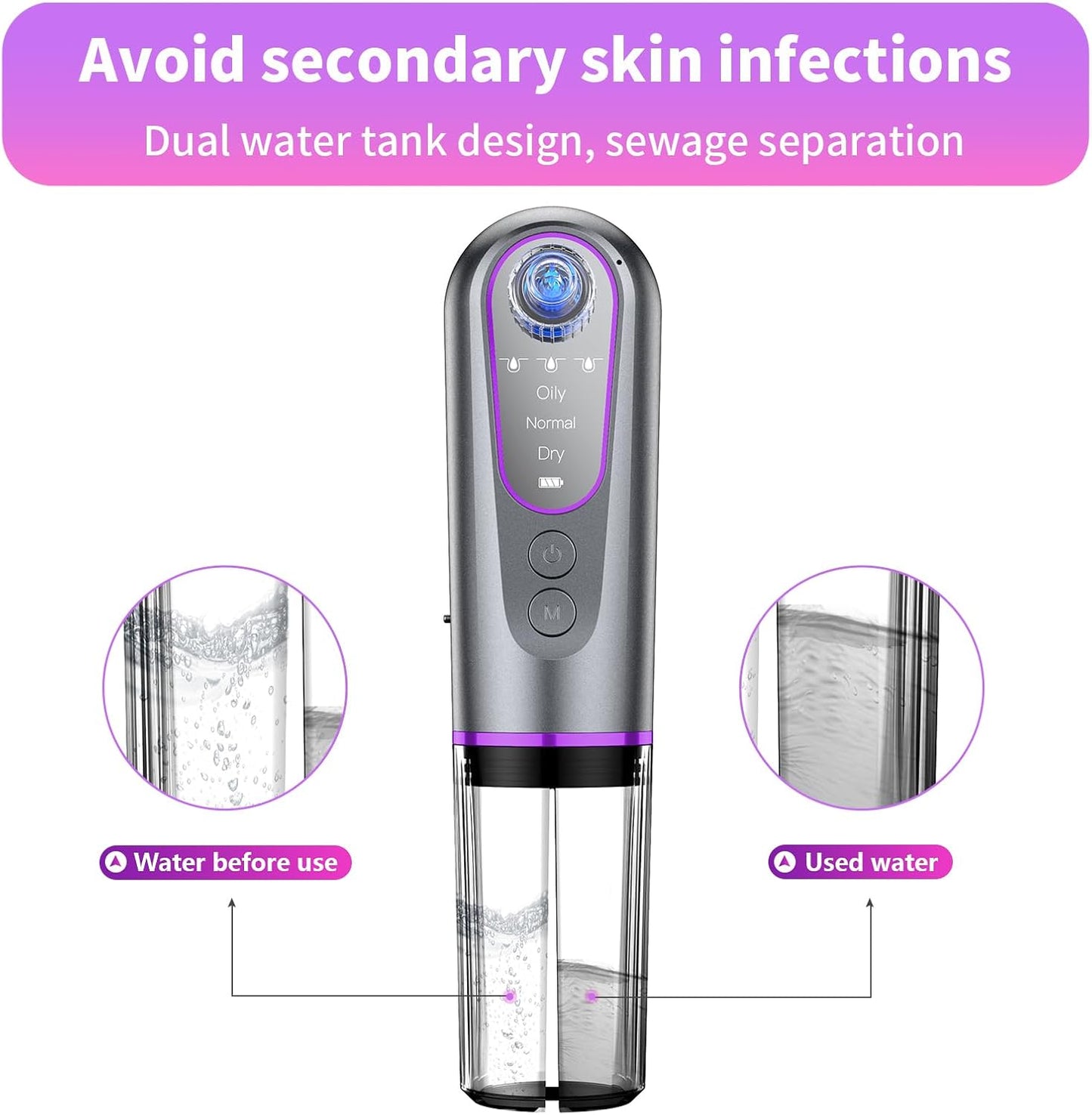 Blackhead Remover Vacuum - Facial Pore Extractor with 3 Suction Levels & 5 Heads for Deep Cleansing | Skin Care Tool