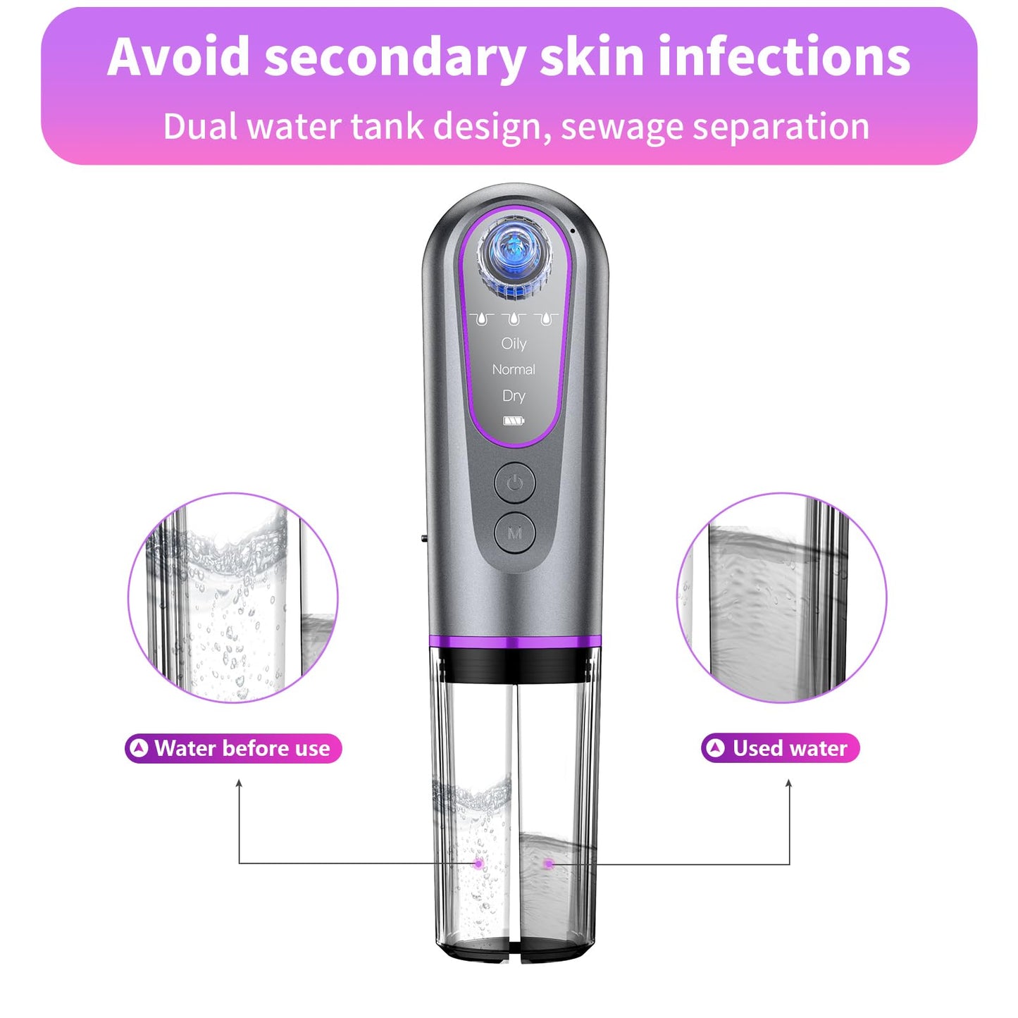 Blackhead Remover Vacuum with Microbubble Cleaning, Facial Pore Extractor & Pro Cleanser Tool, 3 Suction Levels, 5 Replaceable Heads for Deep Cleansing & Skin Care