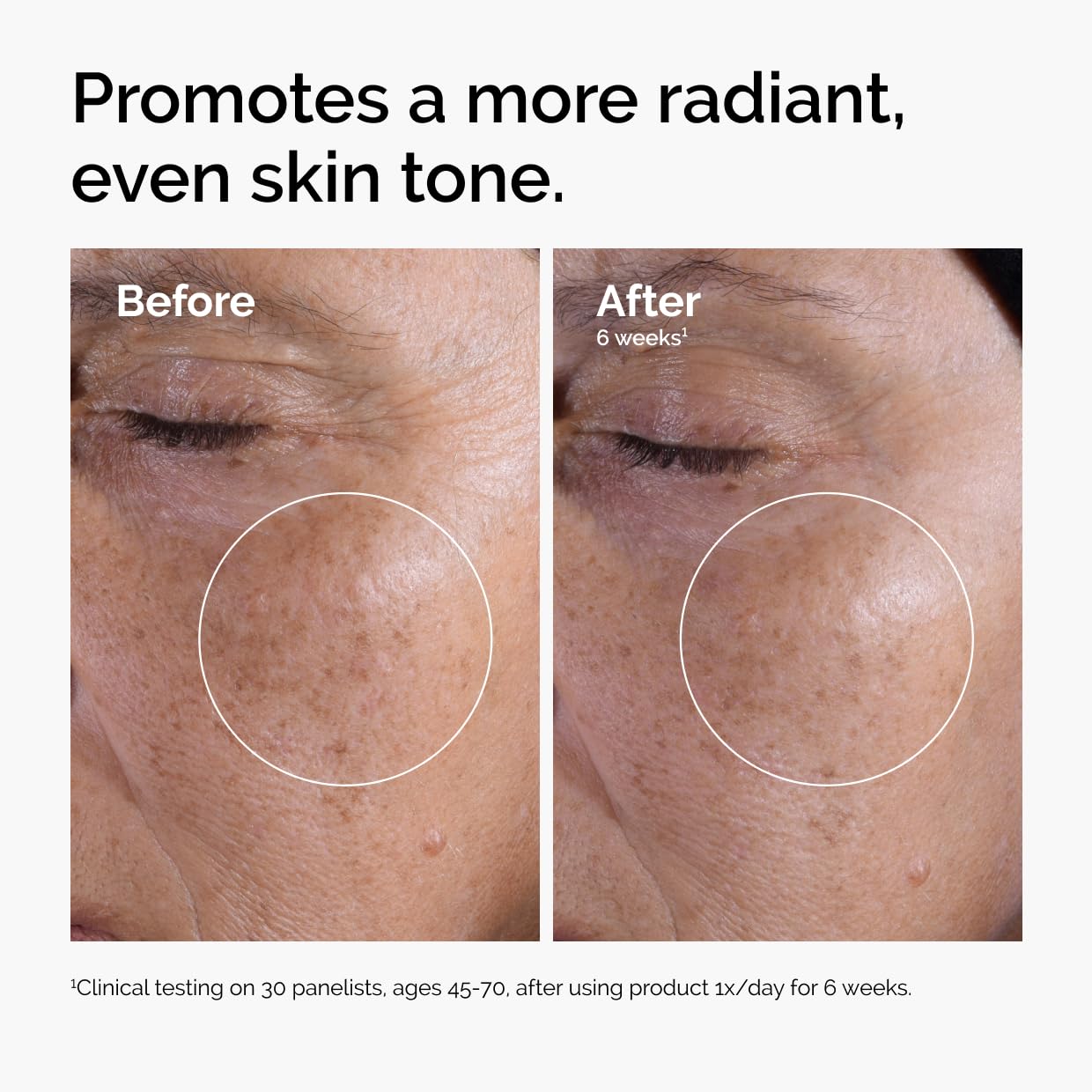 Glycolic Acid 7% Exfoliating Toner - Brightening & Smoothing Daily Toner for Even Skin Tone
