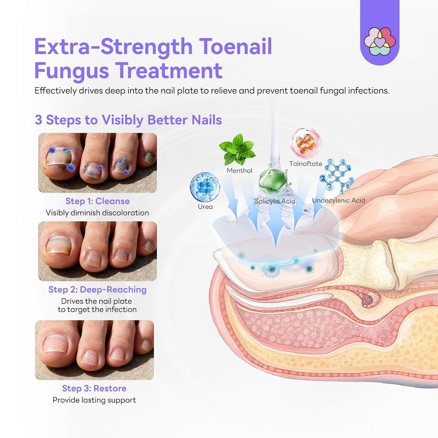 Toenail Fungus Treatment - Extra Strength 2X Nail Repair Solution | FSA-HSA Approved, 1 fl oz