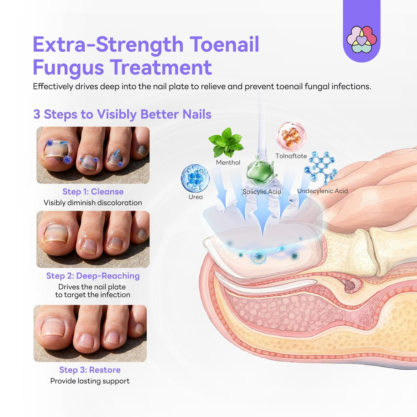 SAVILAND Toenail Fungus Treatment Extra Strength FSA-HSA: 25% Undecylenic Acid & 1% Tolnaftate Nail Fungus Treatment 2X Extreme Nail Repair for Discolored Thick Yellow Damaged Nails 2 fl oz