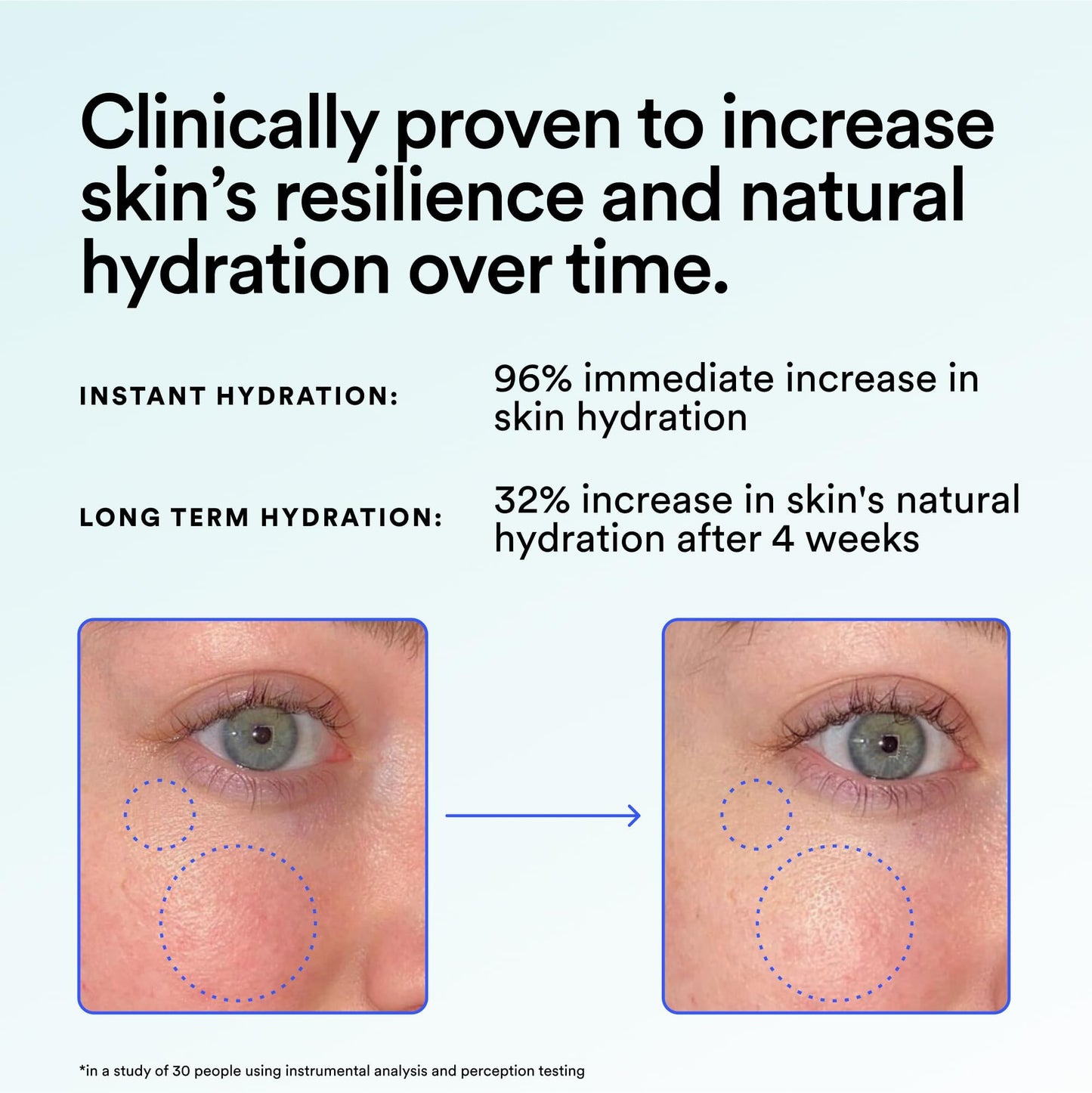 Experiment Super Saturated Ultra Hydrating Barrier Serum - 30% Glycerin, Polyglutamic Acid + Prickly Pear for Intensive Moisture, Plump + Dewy Skin, 1.35 FL OZ - Hydrating Serum for All Skin Types