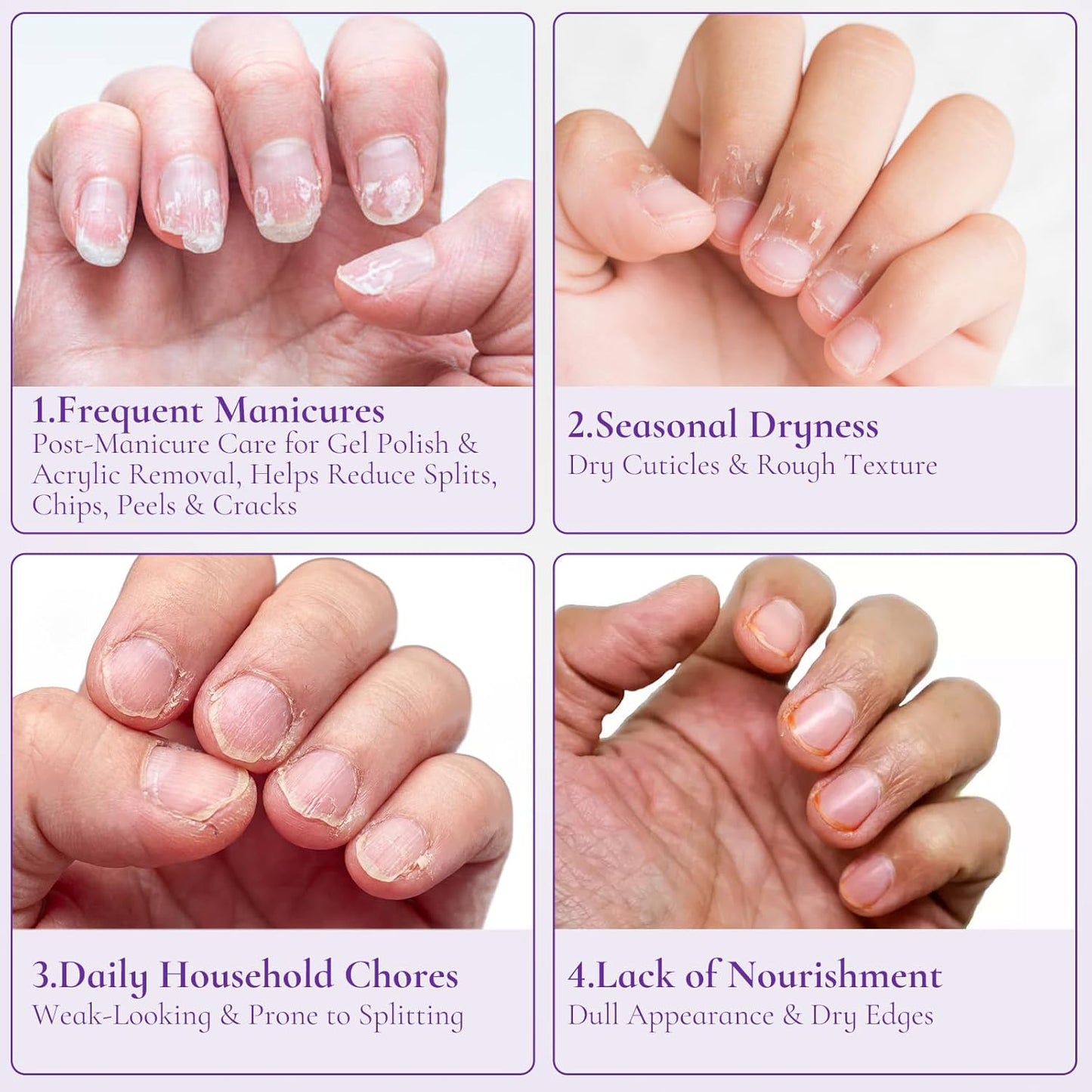 Nail & Cuticle Cream - Keratin, Biotin & Ceramides | Non-Greasy Moisturizer for Dry Cuticles, 0.5 Fl Oz