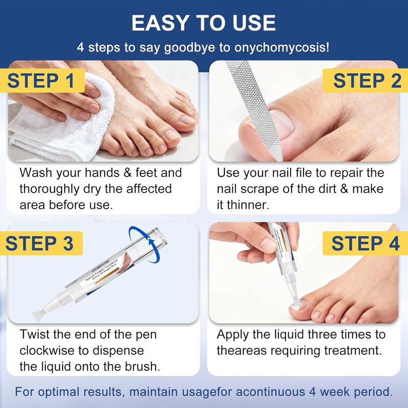 Toenail Fungi Treatment - Extra Strength Fungi Nail Pen with 25% Undecylenic Acid | Effective for Ingrown & Yellow Toenails