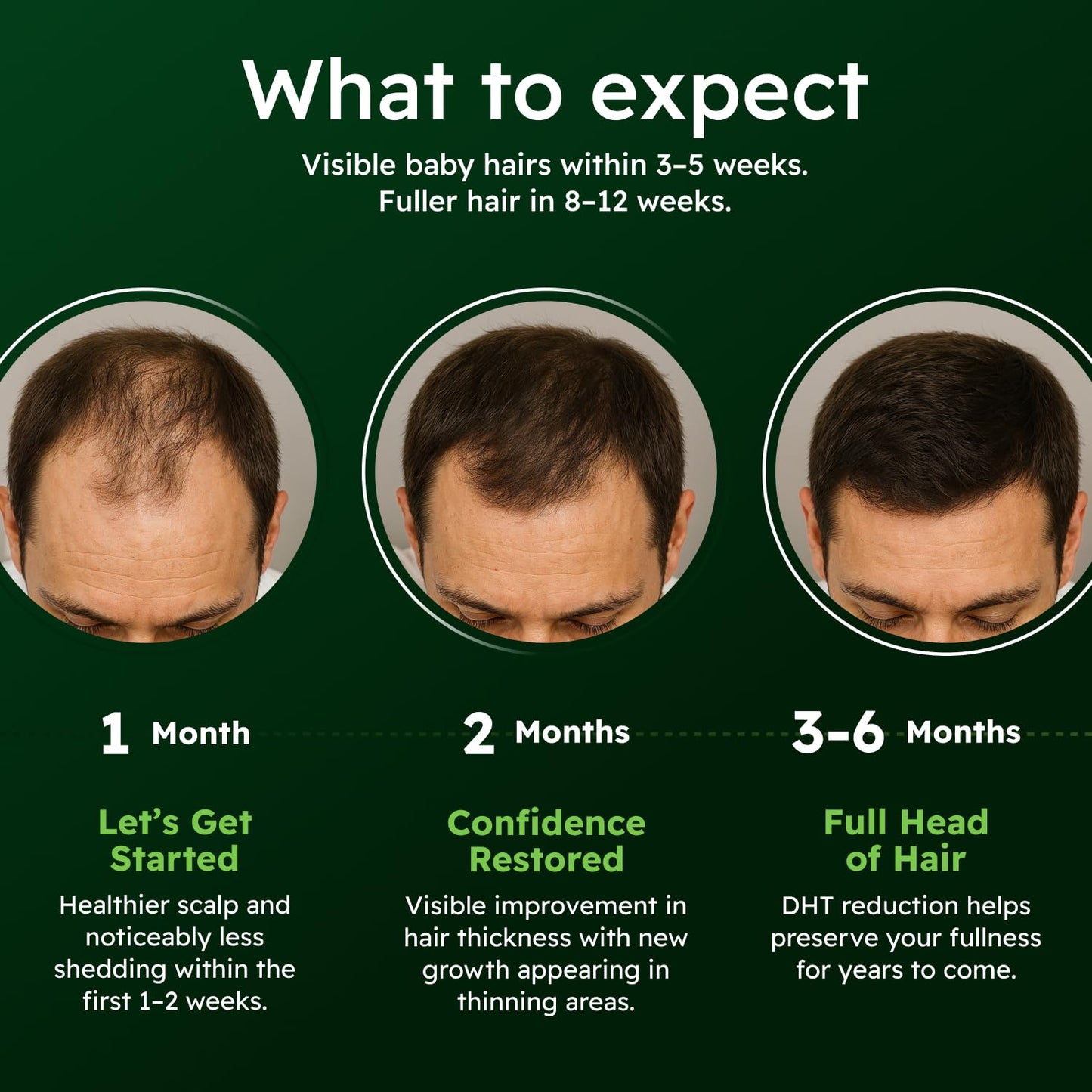 AlphaInfuse™ Scalp Nourishing Serum for Men | Ginseng & Eclipta Blend for Thicker Hair – 32ml, 2-Month Supply