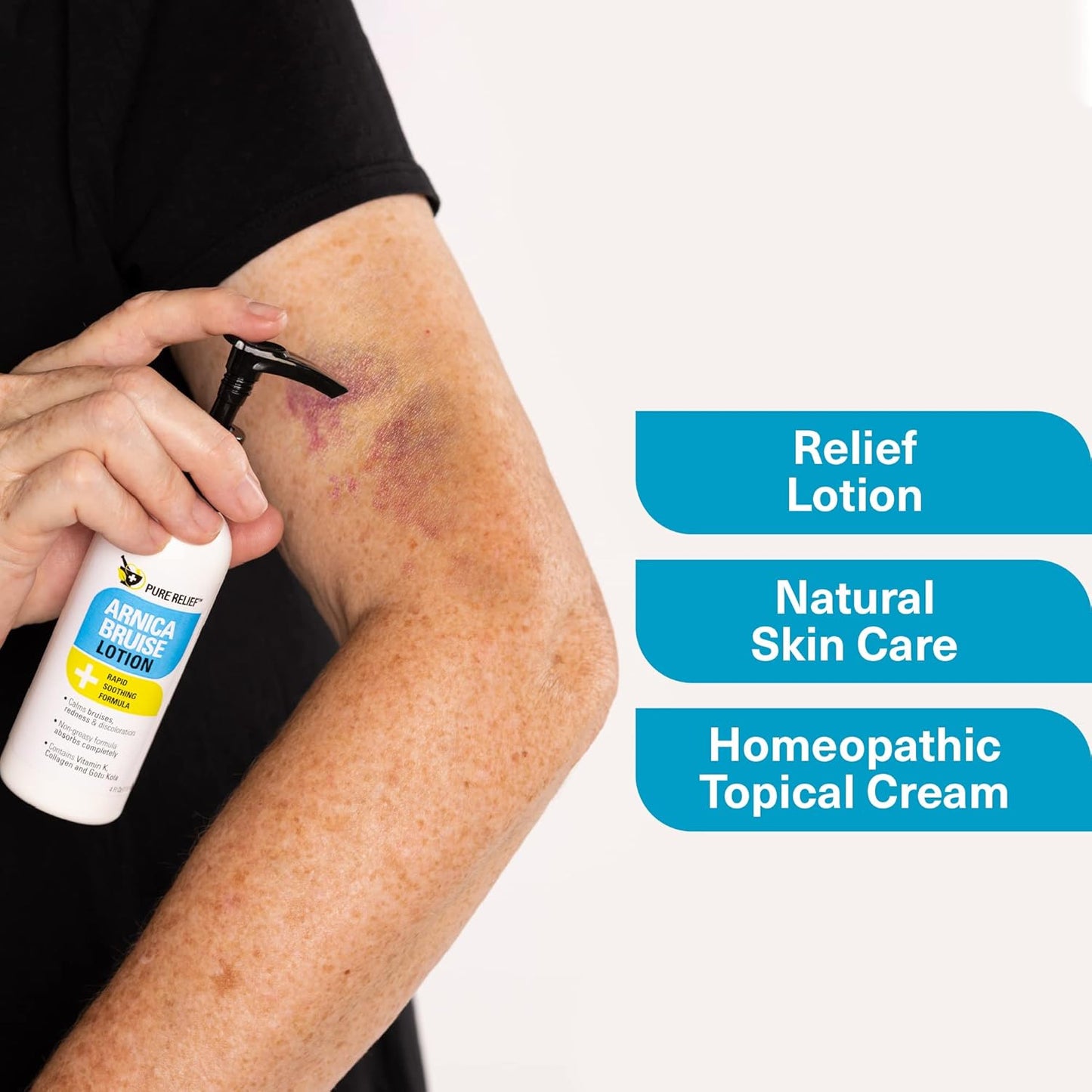 Arnica Cream for Bruise Relief - Extra Strength Moisturizing Formula with Vitamin K & Collagen | 4 Fl Oz