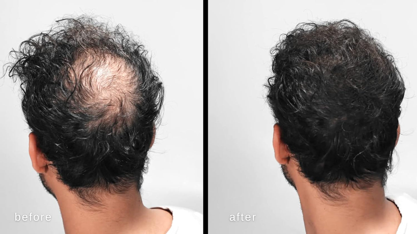 LUXE Hair Building Fibers - Thickening Fibers for Fuller Hair - Hypoallergenic | Auburn Color, 2-Month Supply
