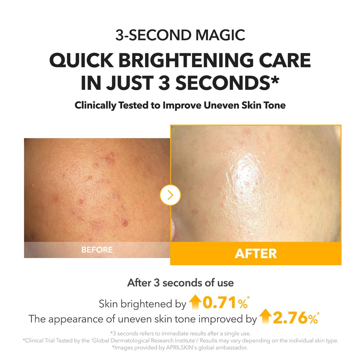 APRILSKIN A.C.E Serum - Vita Kojic Brightening Serum with Kojic Acid & Vitamin C | 3.88 oz for Even Skin Tone