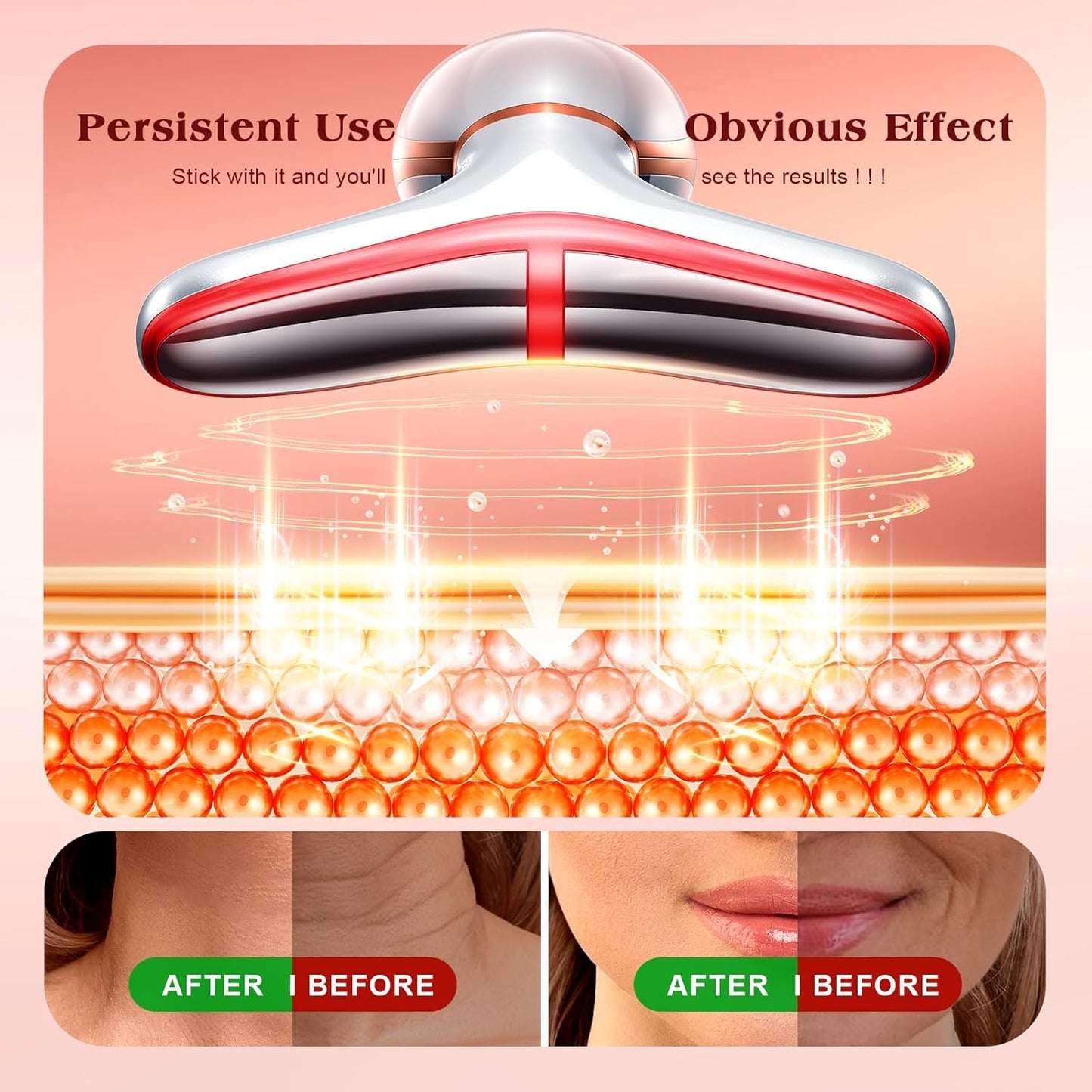 Facial Massager - Red Light Therapy Device for Face & Neck | 113°F Heating Vibration, 7 Color Options