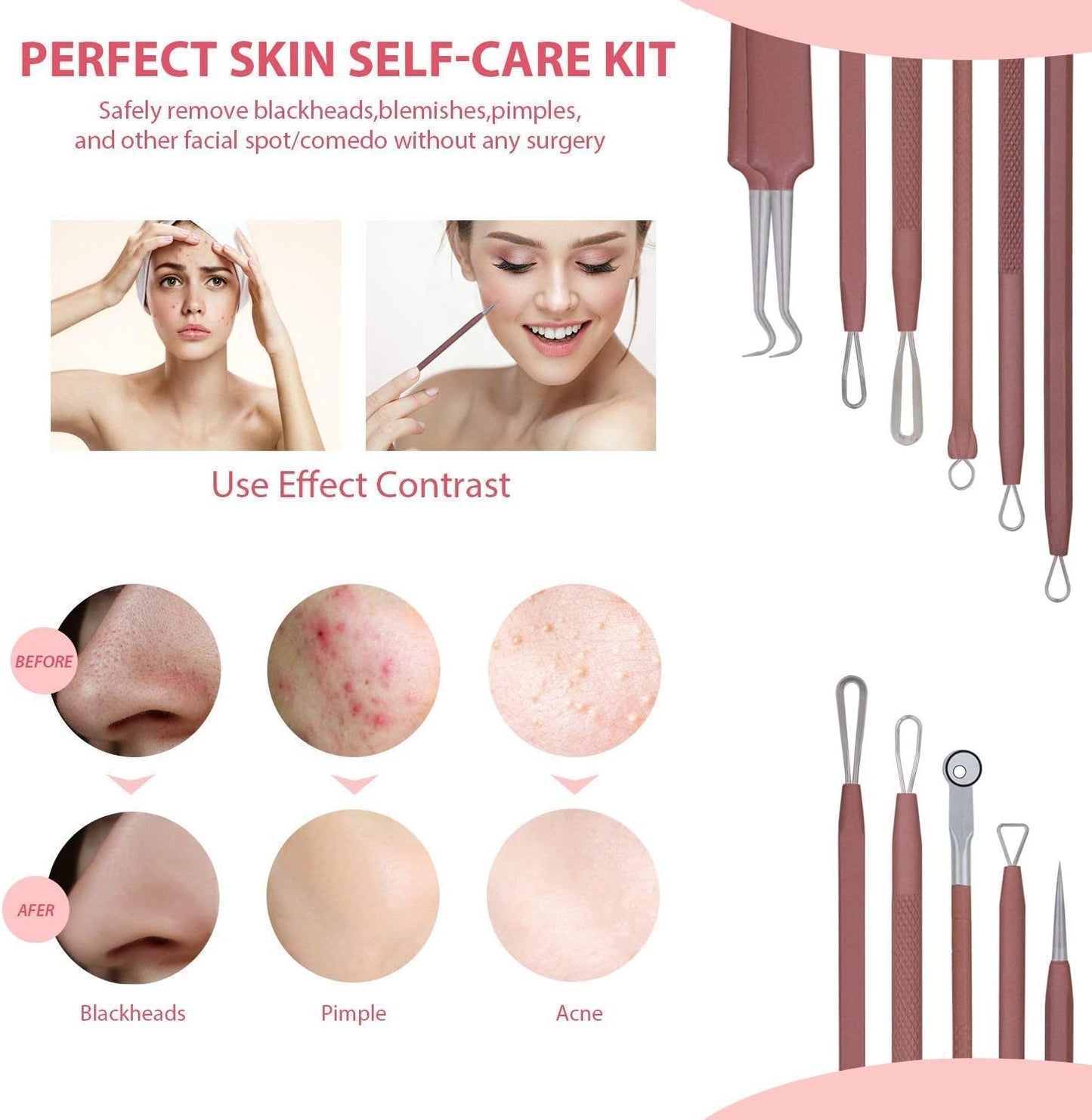 Blackhead Remover Tool Kit - 6 Pcs Comedones Extractor for Acne & Whitehead Removal | Includes Leather Bag (Pink)