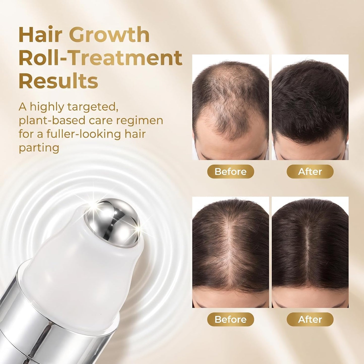 Hair Growth Serum Roll-On | 5% Minoxidil Gel for Men & Women - Anti Hair Loss Treatment (18ml)