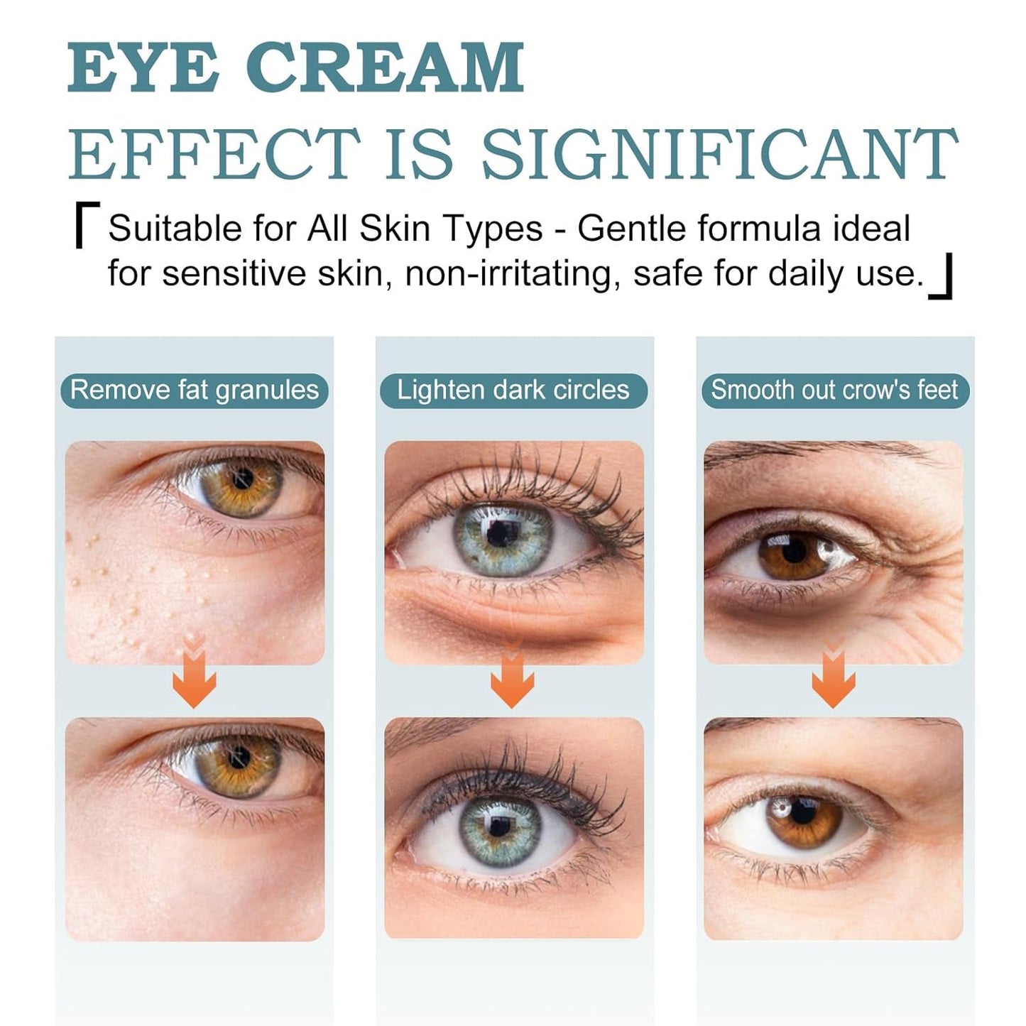 Eye Cream for Dark Circles & Wrinkles - Anti-Aging Formula with Retinol & Hyaluronic Acid | Non-Greasy, Firming Treatment