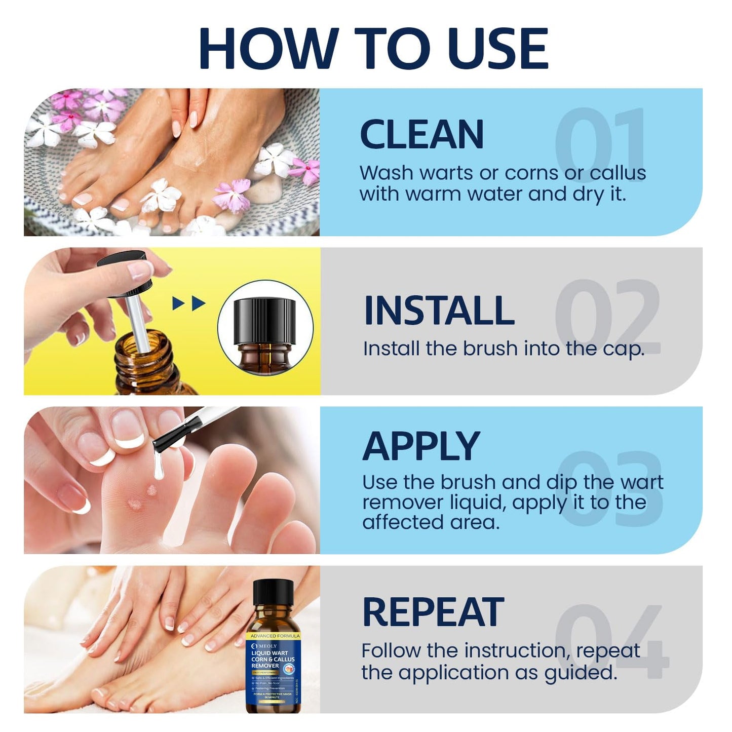 MEOLY Fast-Acting Wart Remover: Salicylic Acid Wart Remover for Plantar Wart, Corn Fast-Acting for Men and Women 30 ML