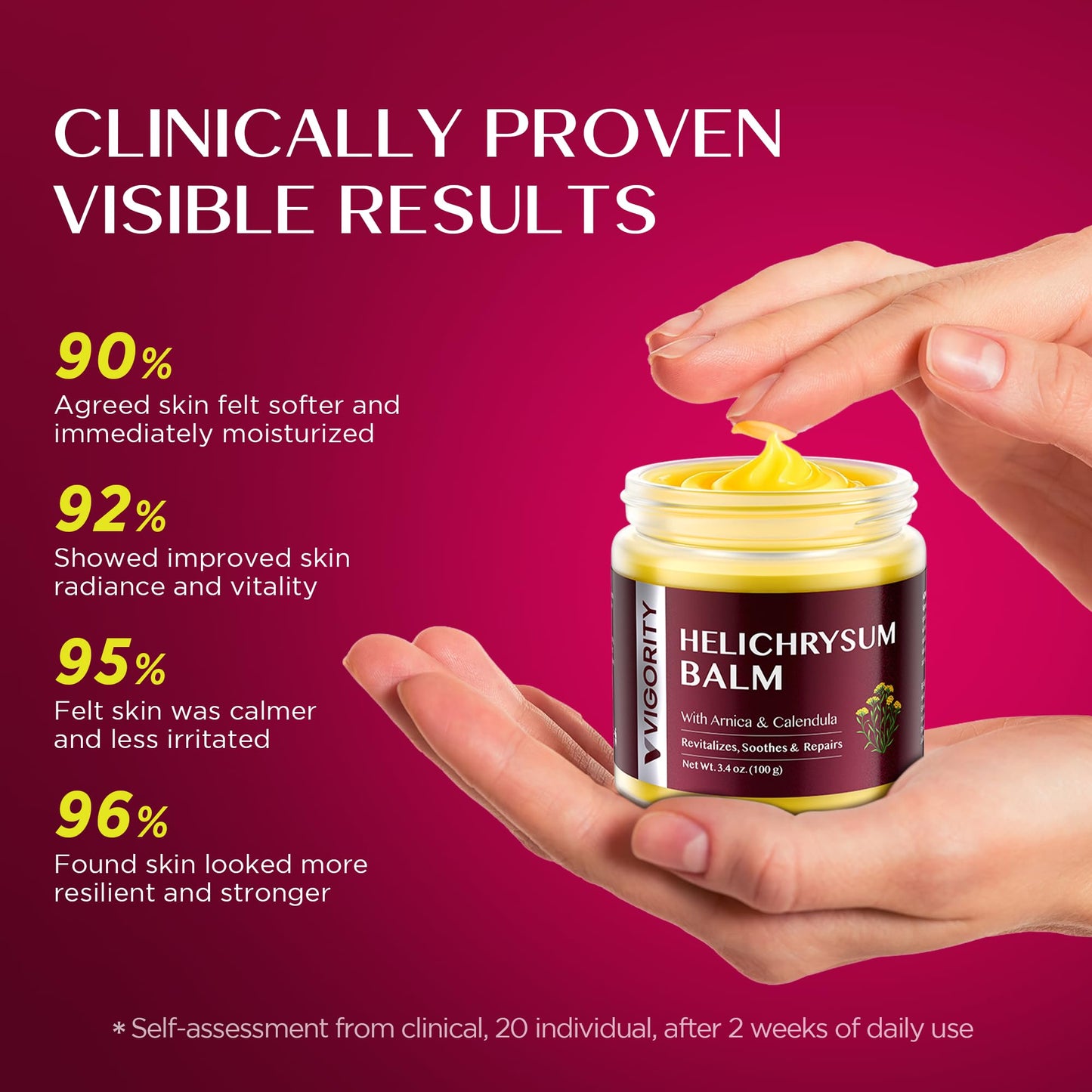 Vigority Helichrysum Balm Soothes & Repairs: Restorative Arnica Cream with Calendula for Fragile, Thin Skin & Bruise-Prone – Moisturizes, Revitalizes & Strengthens Skin Barrier for Adult Seniors 3.4oz