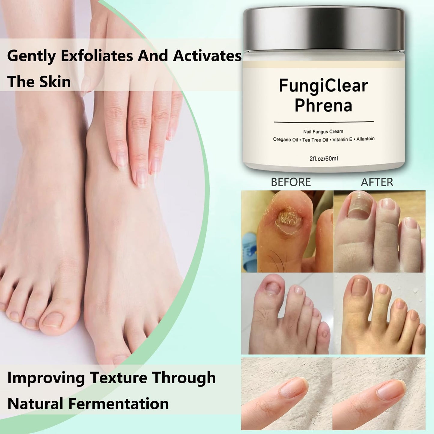 FungiClear Phrena Nail Care Cream,Toenail Nail Repair for Damaged, Strength & Nail Growth Tea Tree Oil, Oregano Oil, Vitamin E 60ml,2.03fl.oz (1pcs)