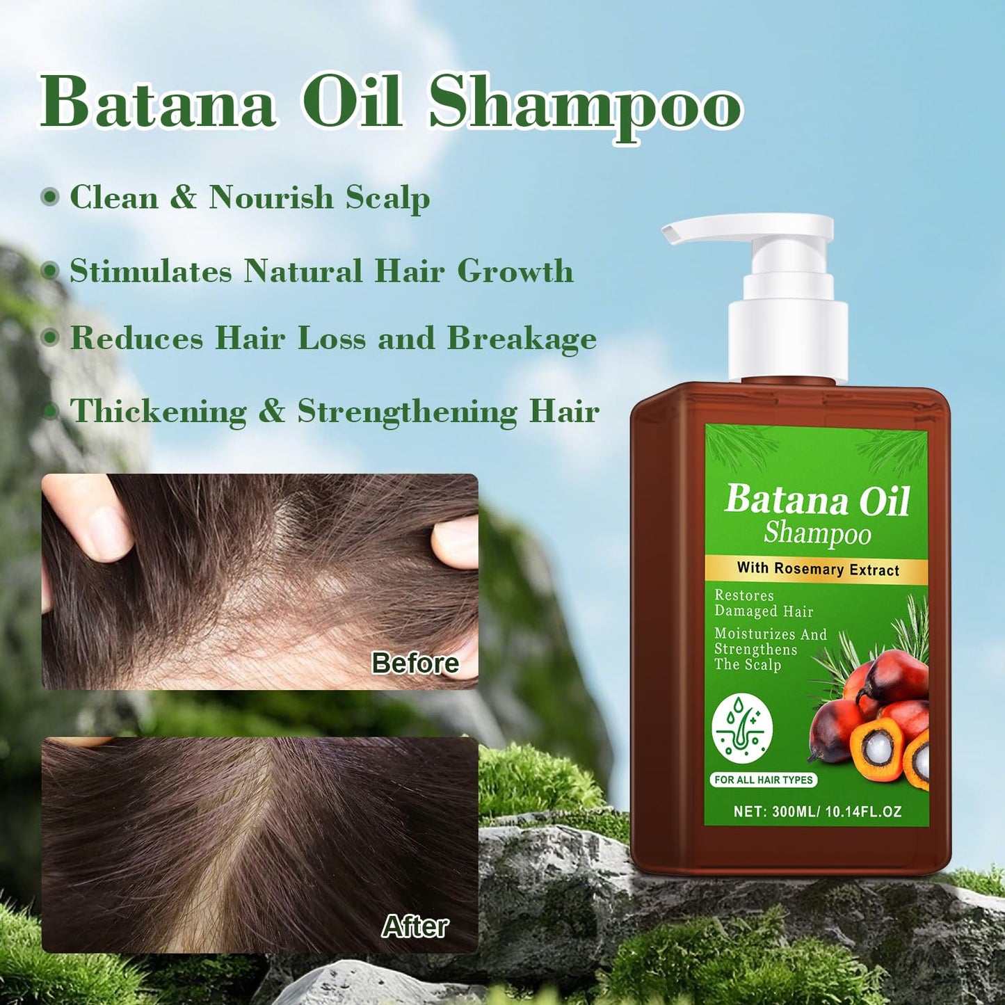 Rosemary Shampoo for Hair Growth - Nourishes Scalp, Reduces Breakage & Adds Shine | 10.1 fl oz