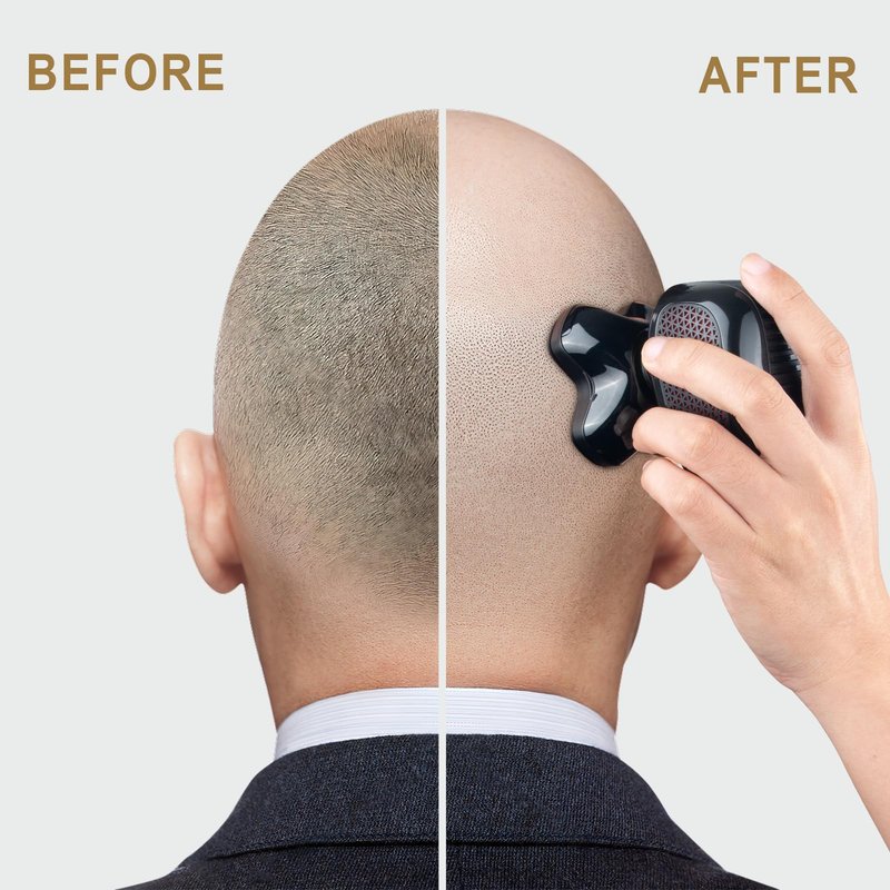 Telfun Magnetic Head Shavers for Bald Men, Cordless 5-in-1 Electric Razor for Fast Shaving- IPX7 Waterproof Wet/Dry Mens Grooming Kit - Easy Use Palm Shaver for a Smooth Bald Shave