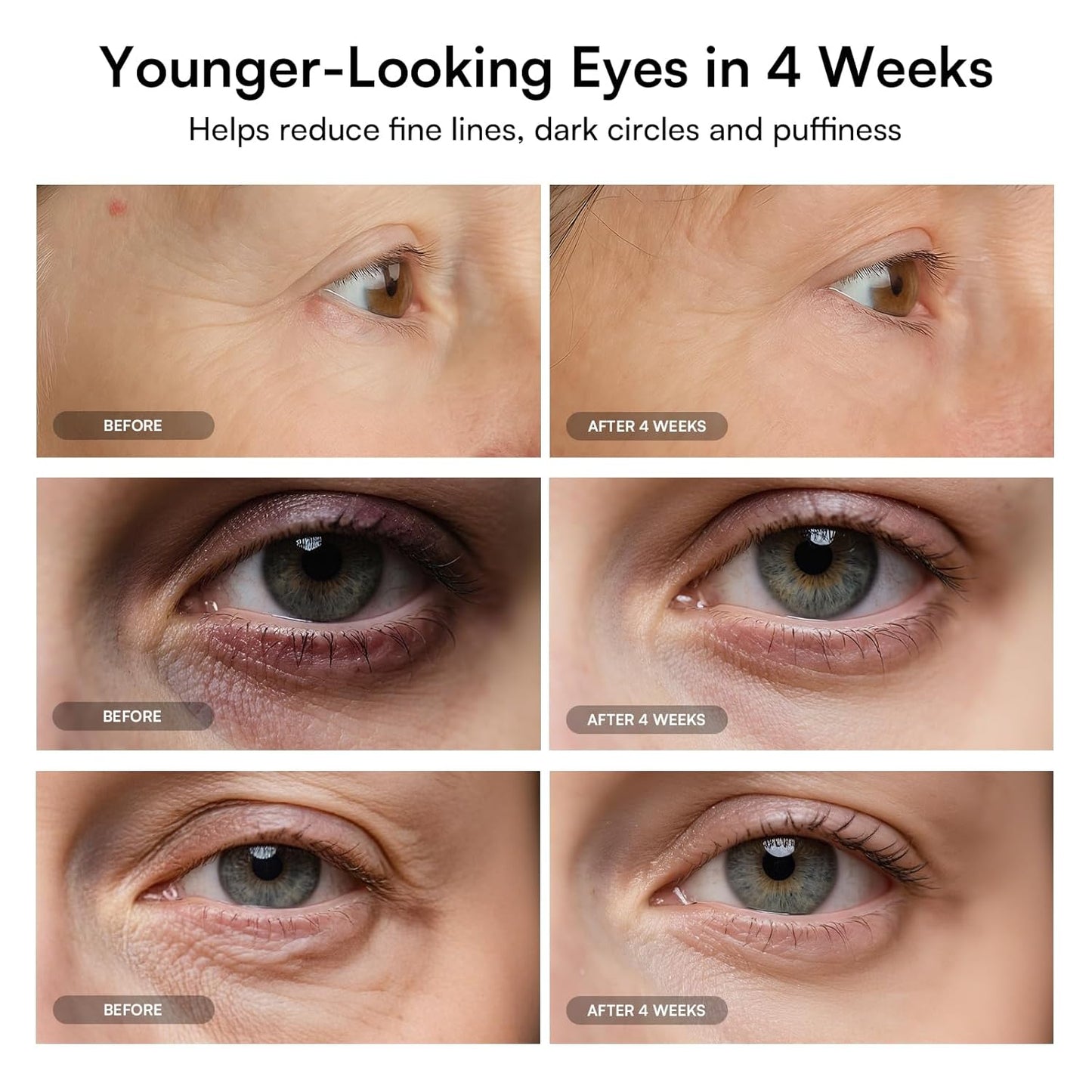 Red Light Therapy Eye Mask - Under Eye Treatment for Dark Circles, Wrinkles & Crow's Feet | Rejuvenating Skincare Device