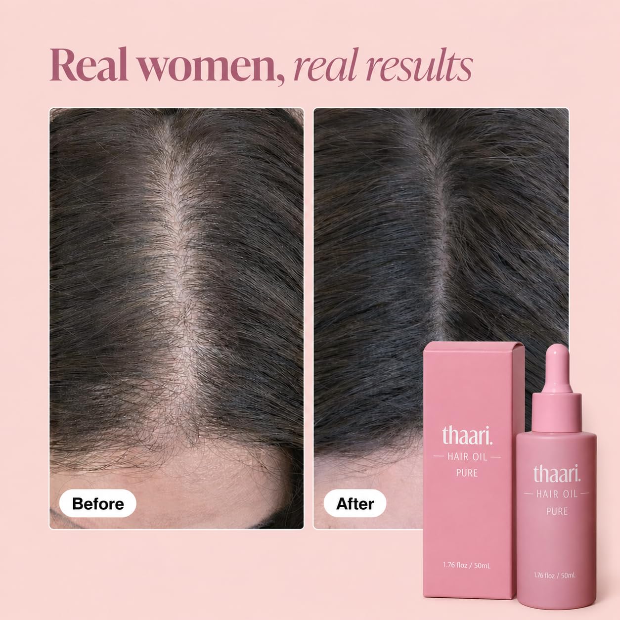 Nourishing Hair Growth Oil Serum - Reduces Breakage & Promotes Healthy Hair | 1.76 fl oz (50 ml)