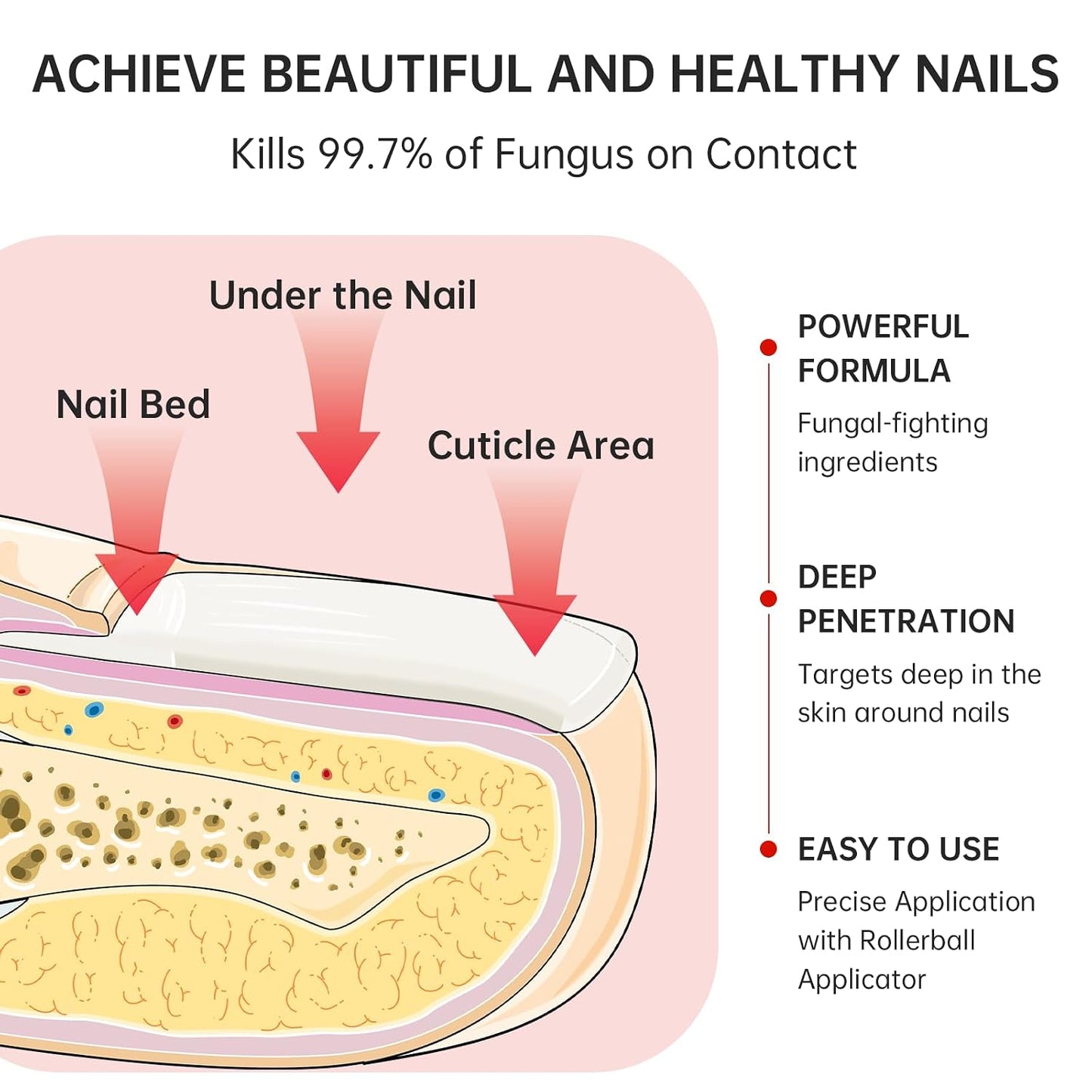 Nail Fungus Treatment - Extra Strength 1% Tolnaftate | Plant-Based Formula for Thickened Nails, 0.51 fl. oz.