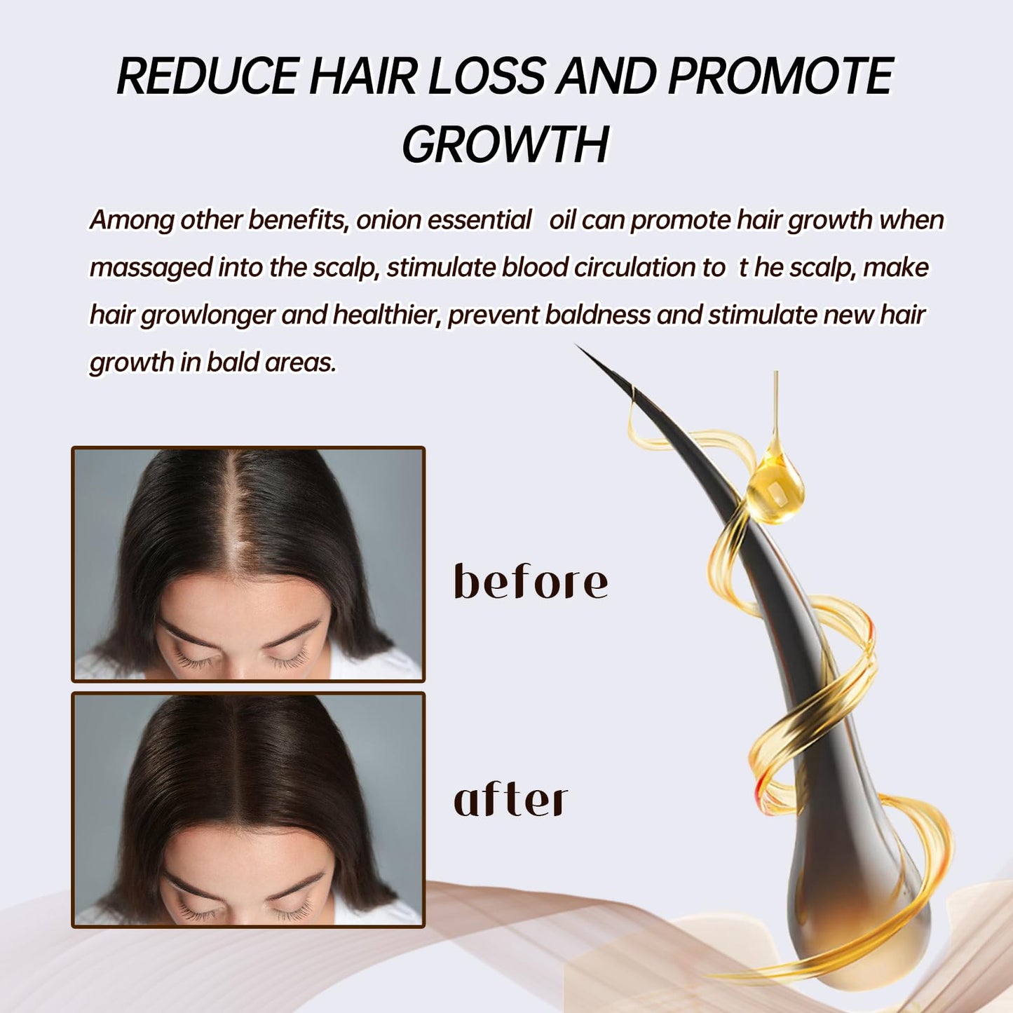 Onion & Rosemary Hair Growth Serum with Biotin & Arginine - Hydrating Scalp Treatment for Thicker Hair, 60ml