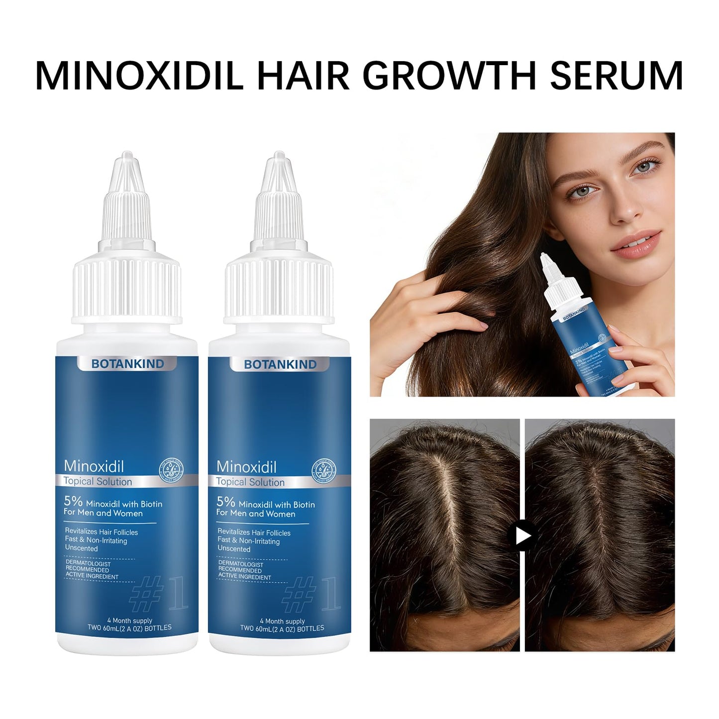 5% Minoxidil with Biotin for Men and Women, Hair & Beard Growth Serum, Topical Minoxidil Solution for Thinning Hair Loss，Extra Strength, 2 Pack