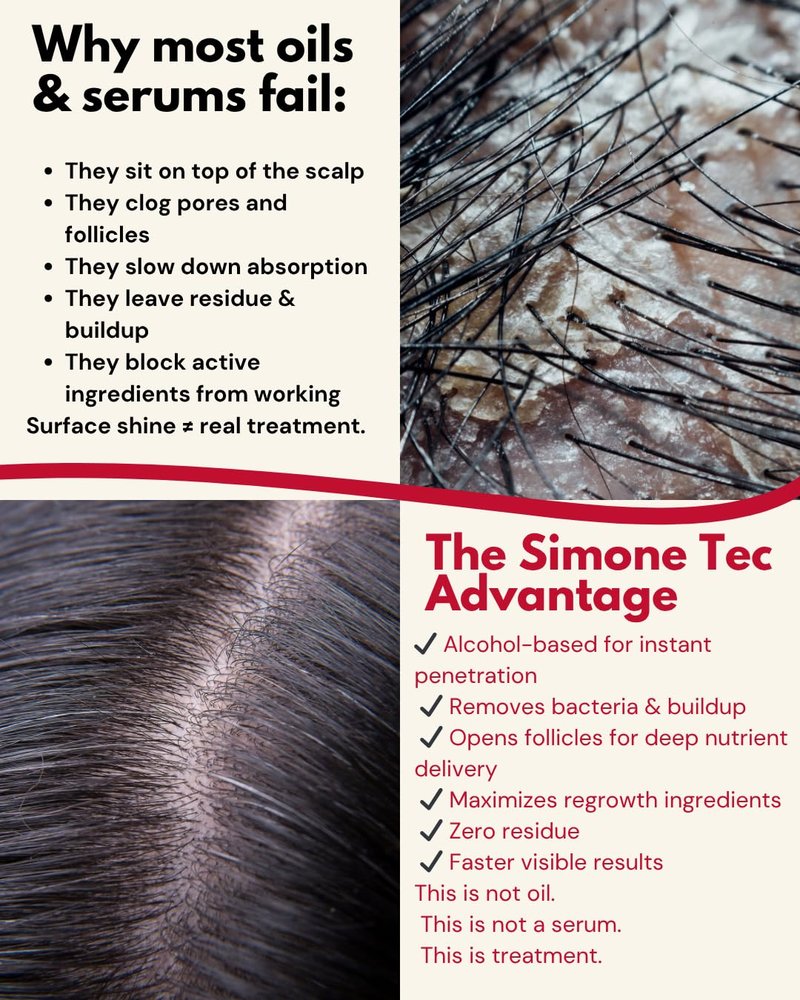 Dermo Pre-After Capillary Mask 236ML - Purifying & Revitalizing Scalp Treatment | Promo 10ML Included