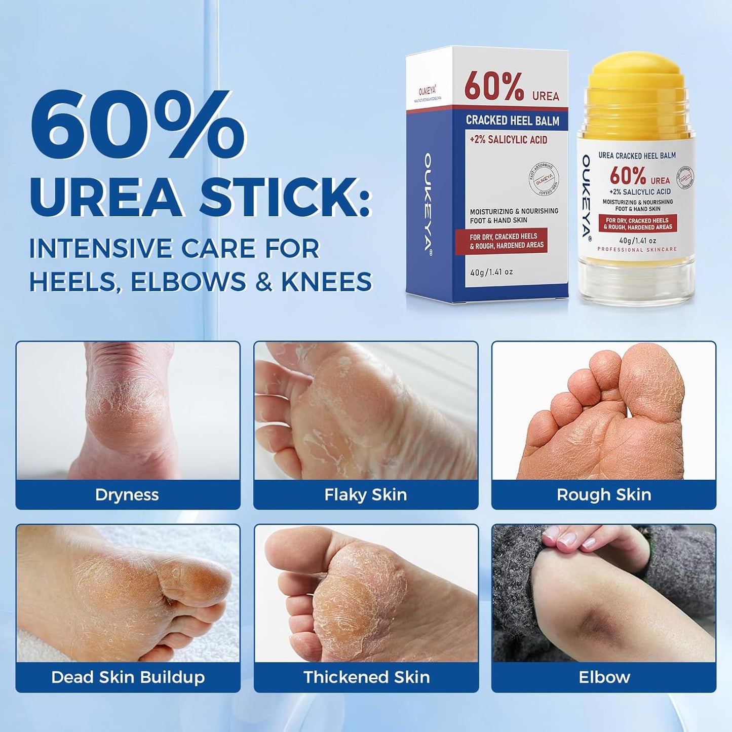 Urea Cream 60% with 2% Salicylic Acid - Maximum Strength Exfoliating Moisturizer for Dry Cracked Heels, Hands, Knees | 1.41oz