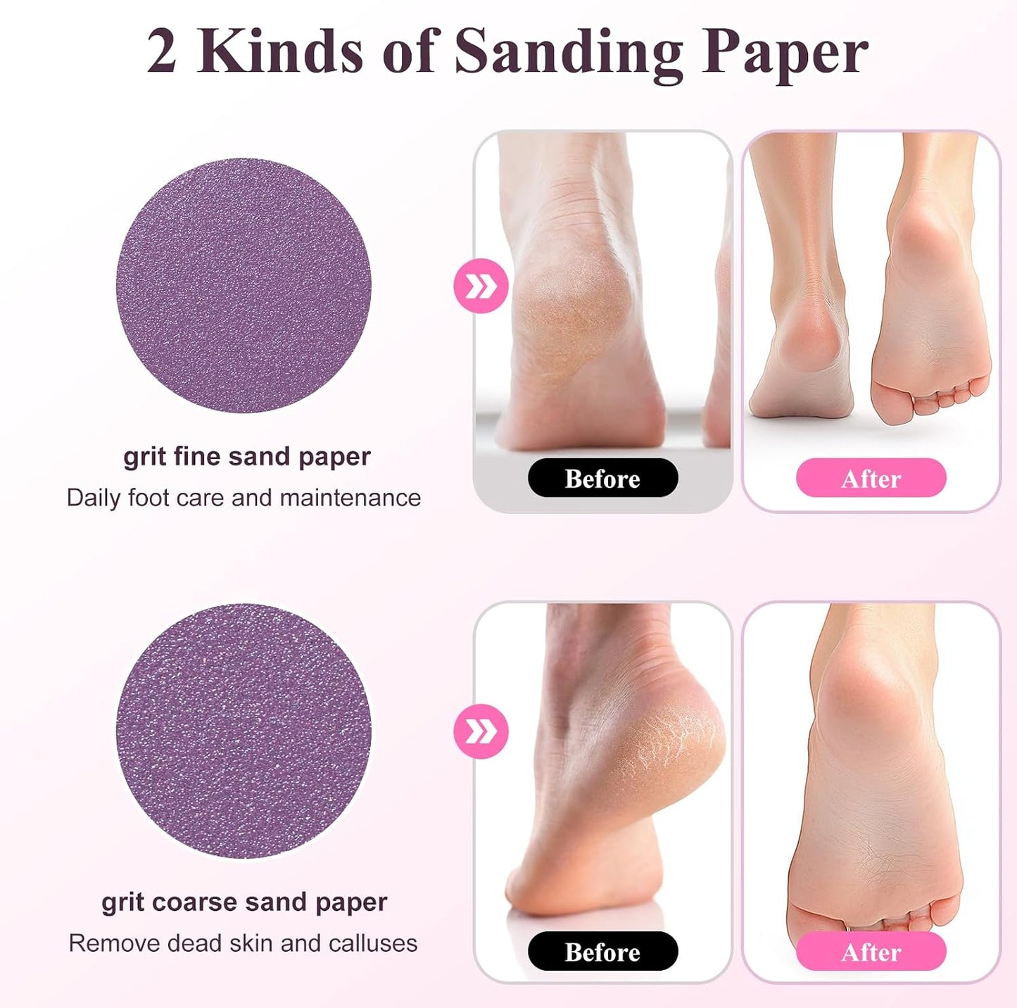 Electric Foot Callus Remover - Rechargeable Waterproof Pedicure Tool | Portable Foot File for Dead Skin Care (White)