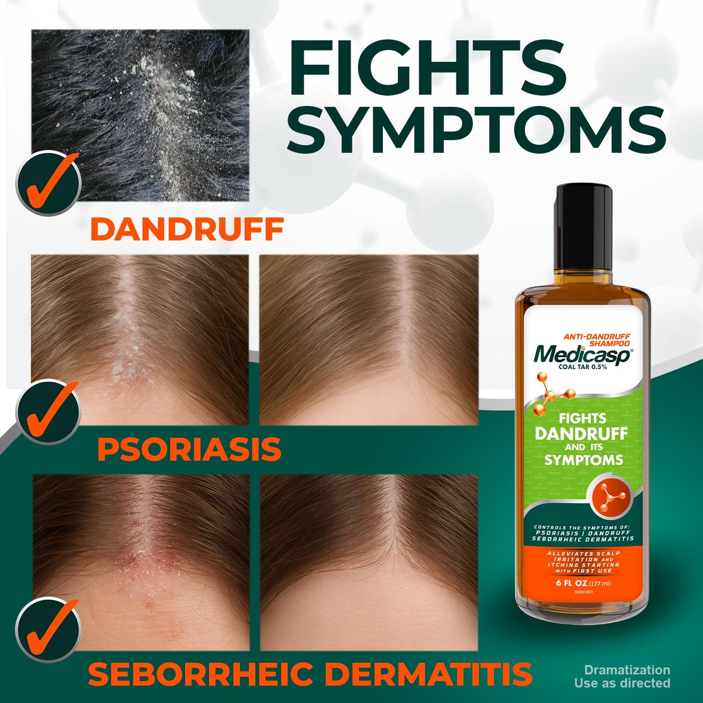 Medicasp Coal Tar Anti-Dandruff Shampoo - Relieves Itchy Scalp & Psoriasis | 6 Fl Oz