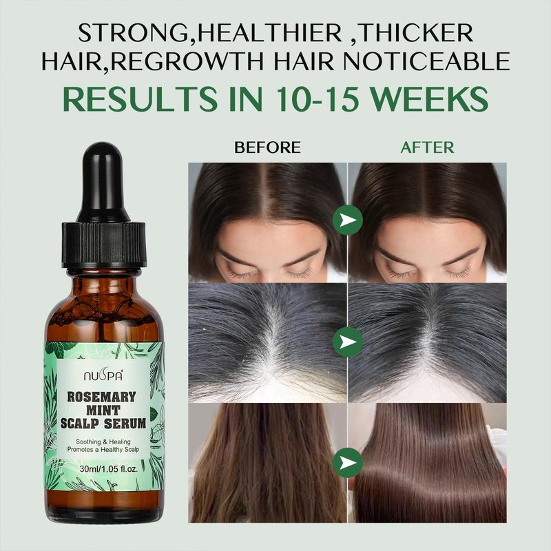 NUSPA Natural Rosemary Mint Hair Serum Grow Long Scalp Moisturizer Infused with BIOTIN Zero Fragrance Reduce Hair Loss for Hair Regrowth,Daily Dry Scalp Treatment