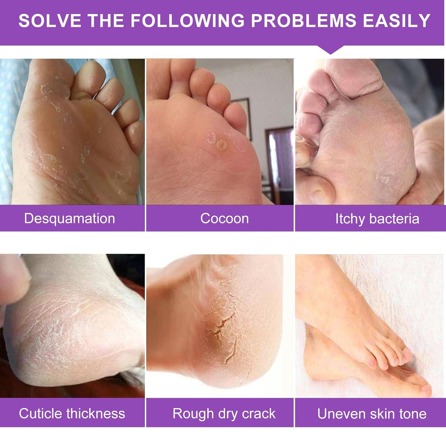 Foot Peel Mask - 5 Pack Exfoliating Treatment for Dead Skin, Calluses & Cracked Heels | Lavender Scent