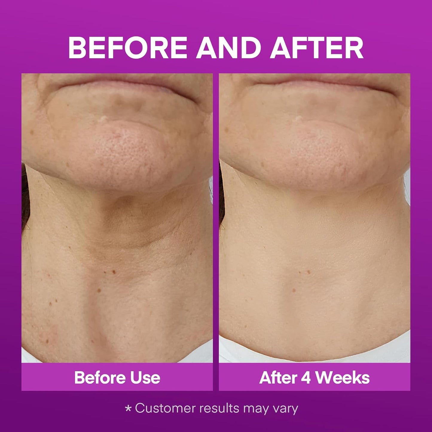 Crepey Neck Firming Cream - Hydrating Peptide & Bakuchiol Moisturizer for Wrinkles | 1.69 fl oz