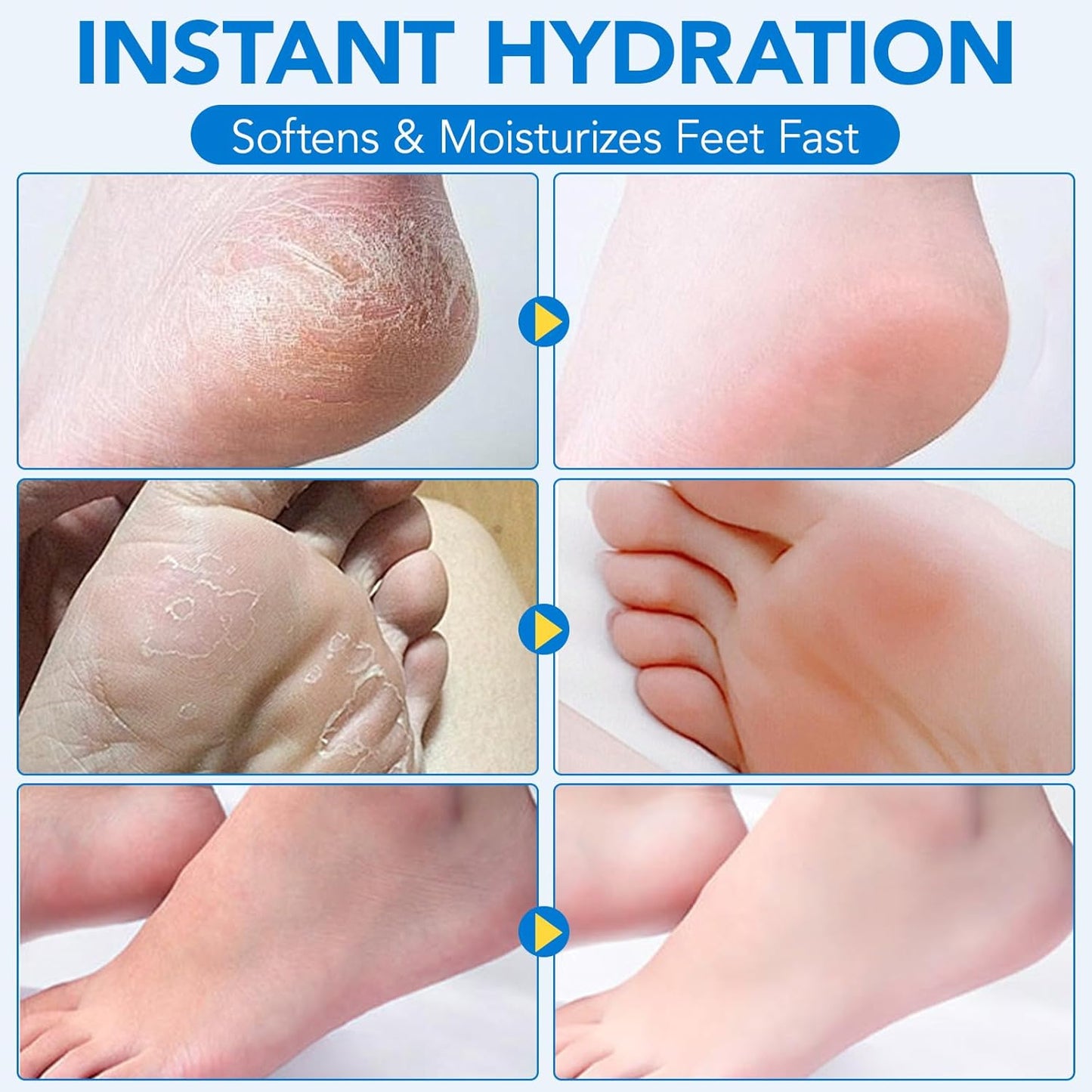 Urea Cream 60% with Salicylic Acid - Foot Care Stick for Callus Removal | Moisturizing Balm for Dry Cracked Heels & Feet