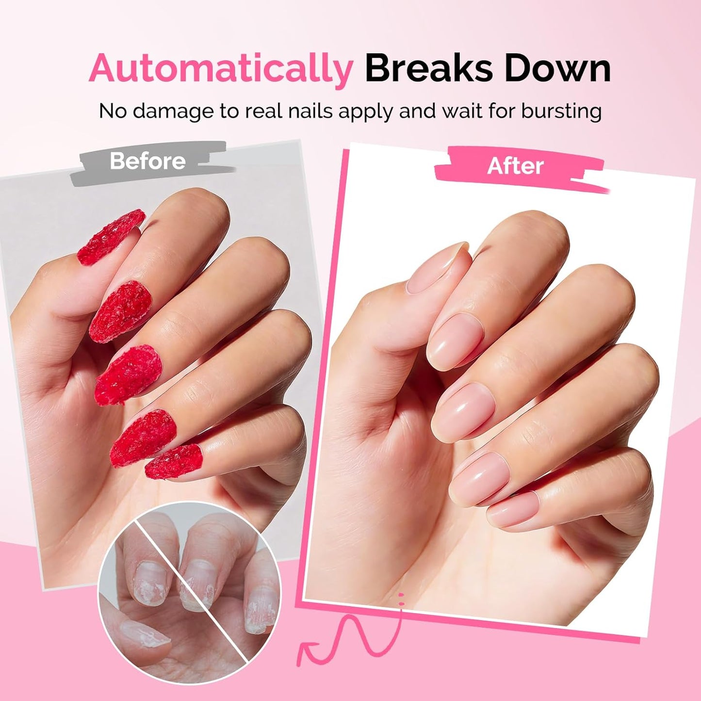 Gel Nail Polish Remover Kit - Quick 5-Minute Removal, No Soaking Needed | 15ml