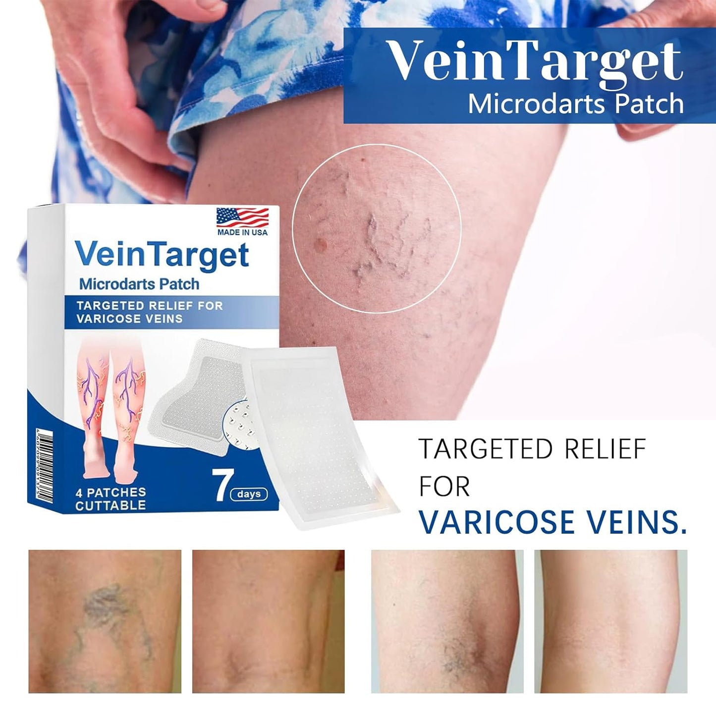 VeinTarget Microdarts Patch - Professional Varicose Veins Treatment for Legs | Natural Ingredients, 1 Pack