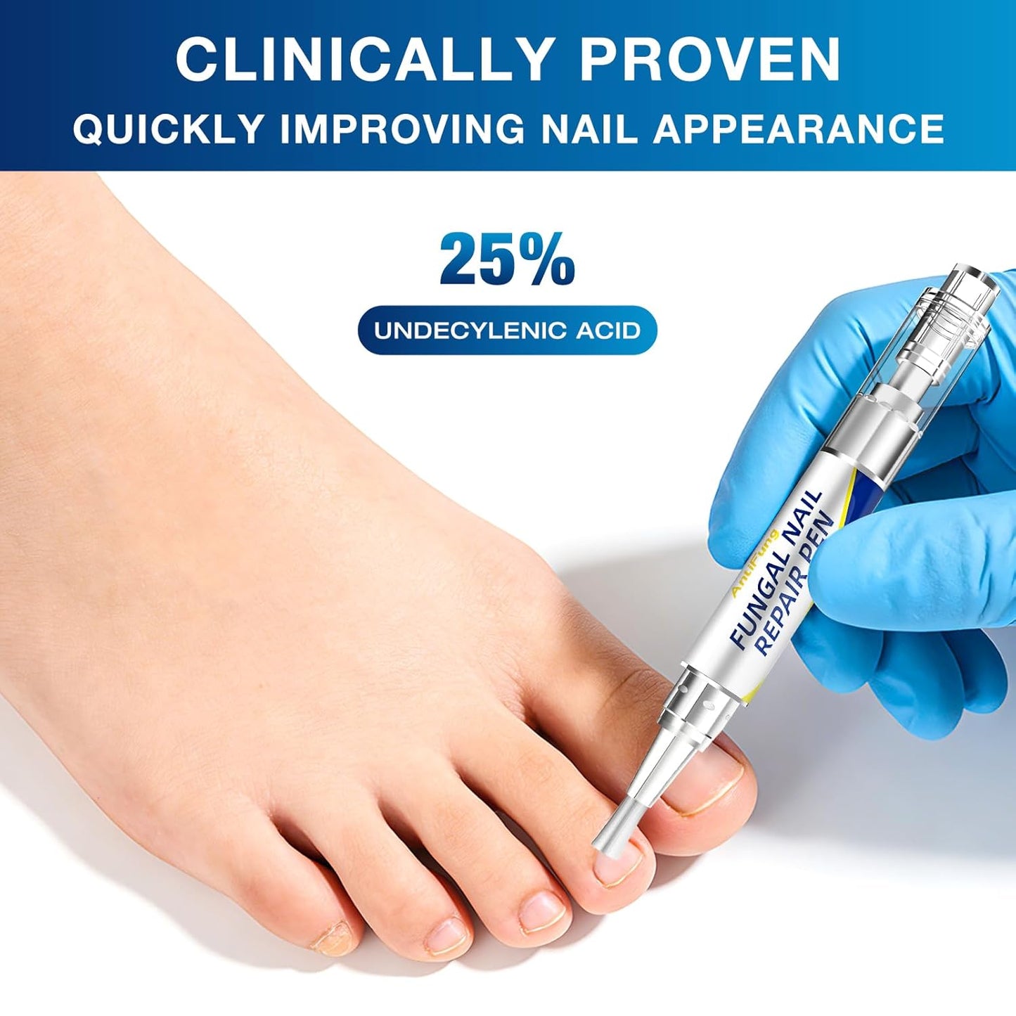Toenail Fungus Treatment - Extra Strength Anti-Fungal Pen | 25% Undecylenic Acid for Damaged & Discolored Nails - 3-Pack