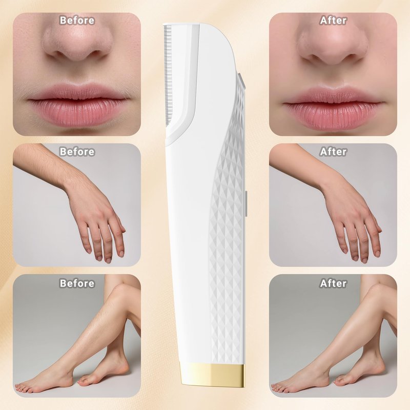 Gelpal Electric Dermaplane Razor for Women Face, Three-Speed Rechargeable Dermaplane Razor with 5 Refill Blades, Facial Hair & Peach Fuzz Remover for Women,Gift wrapping.(White)