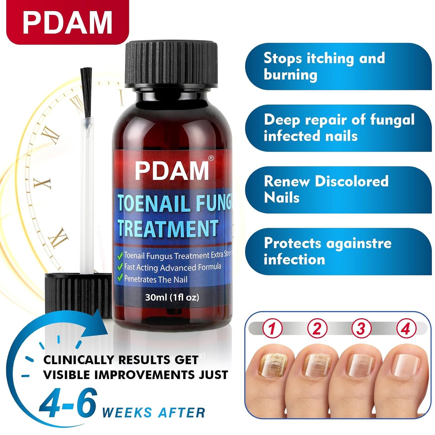 Toenail Fungus Treatment - Extra Strength Nail Strengthener for Thick, Discolored & Ingrown Nails | 30ml