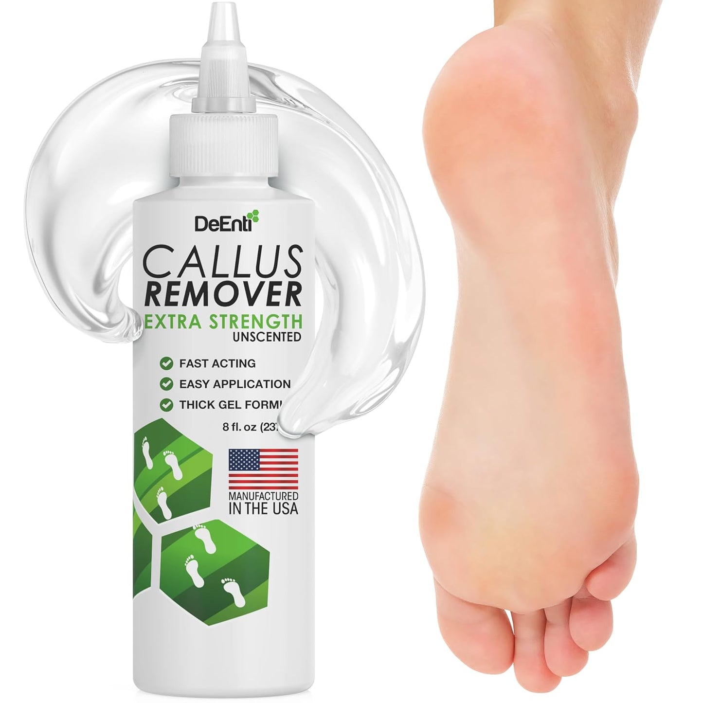 Callus Remover Gel for Feet - Extra Strength 8oz | Professional Pedicure Supplies for Dry Skin & Cracked Heels