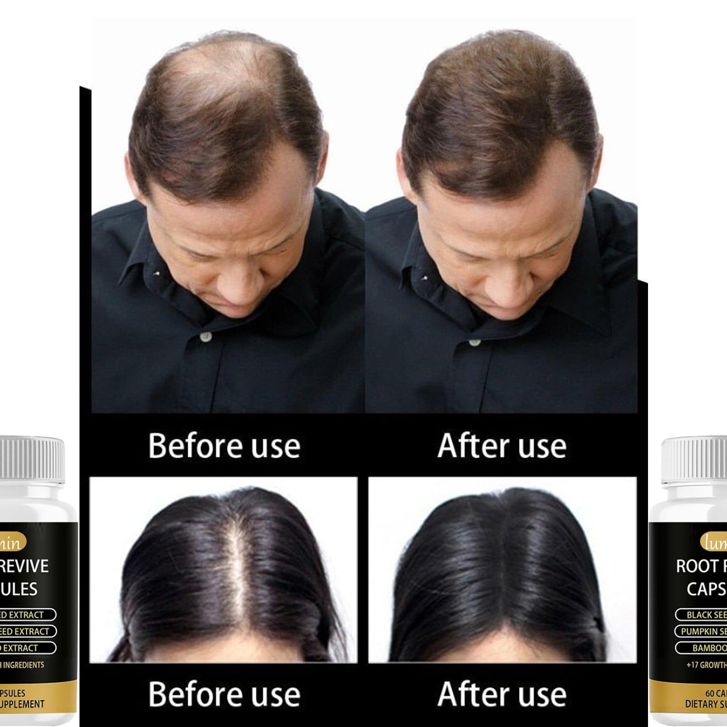 Lumin Root Revive Capsules - Hair Growth Supplement with Biotin & Black Seed Extract | 60 Count for Thinning Hair