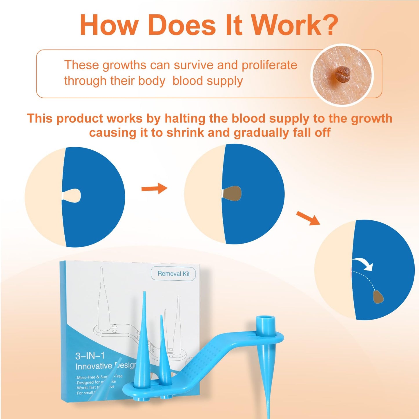 Nodhaul AL-40 Skin Removal Kit, Removal Tools for Home use, Best Tools to Make Your Better, Beauty Remover kIt for Men & Women
