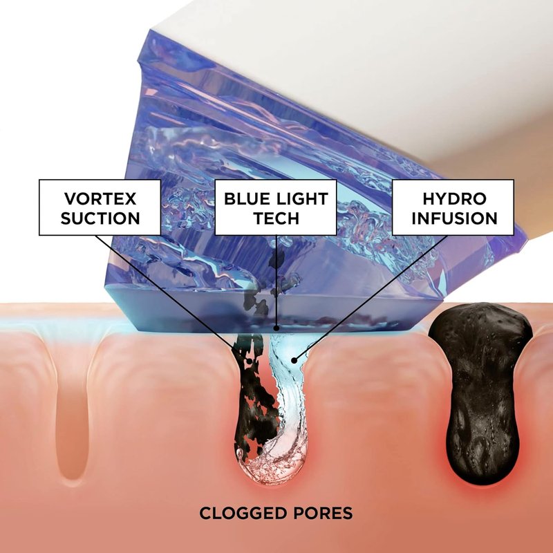 GLOfacial Pore-Cleansing Facial Tool - At-Home Hydration Device for Radiant Skin