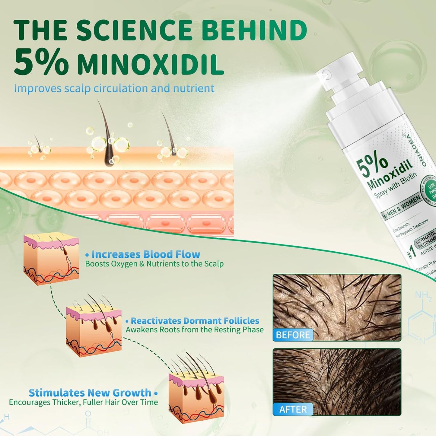 5% Minoxidil Hair Growth Spray - Extra Strength Regrowth Treatment with Biotin & Castor Oil | 4-Pack (8.12oz) for Men & Women