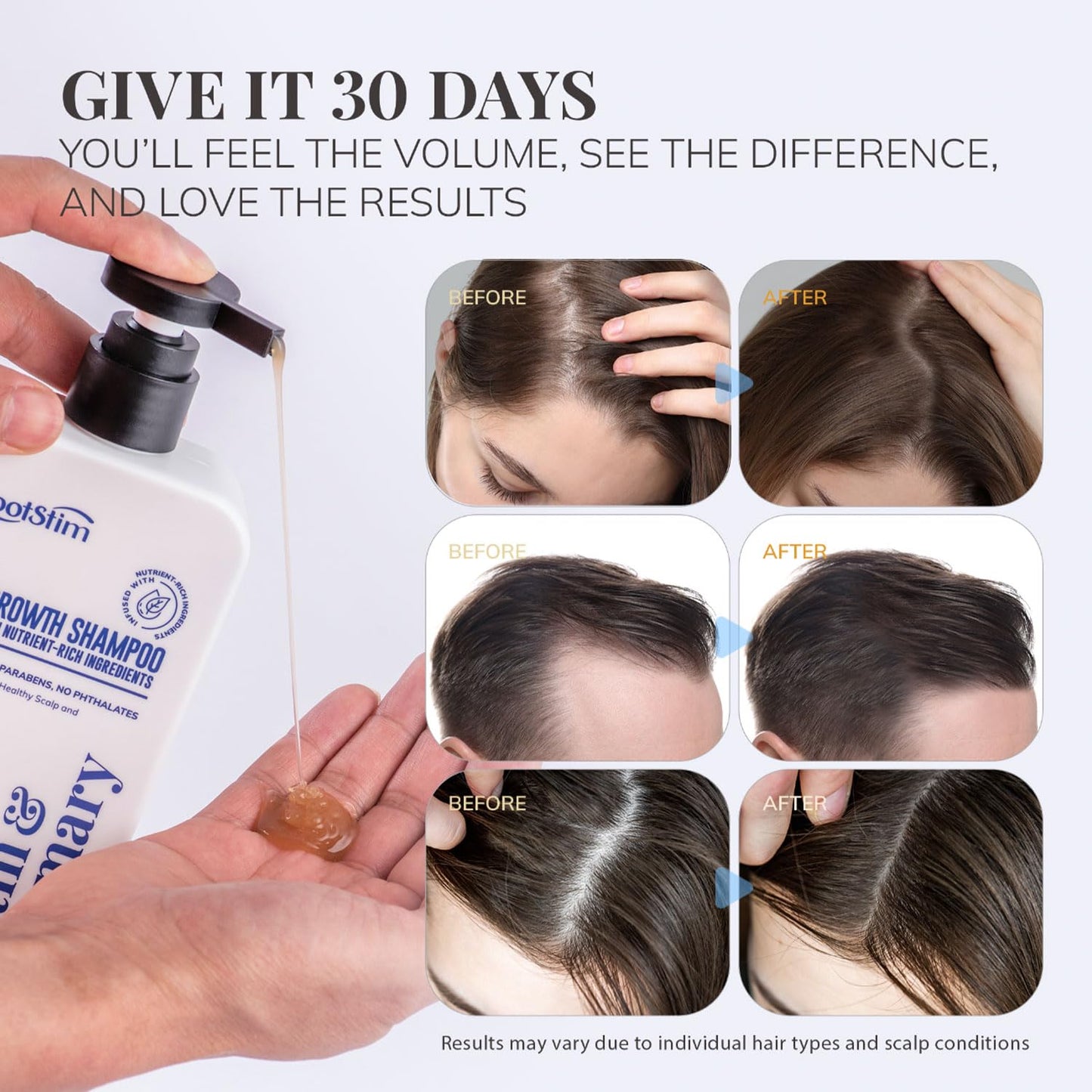 Biotin & Rosemary Shampoo for Hair Growth: Hair Loss Shampoo for Thinning Hair Infused with Natural Nutrient Rich Ingredients for Hair thickening Sulfate Free 10 fl oz