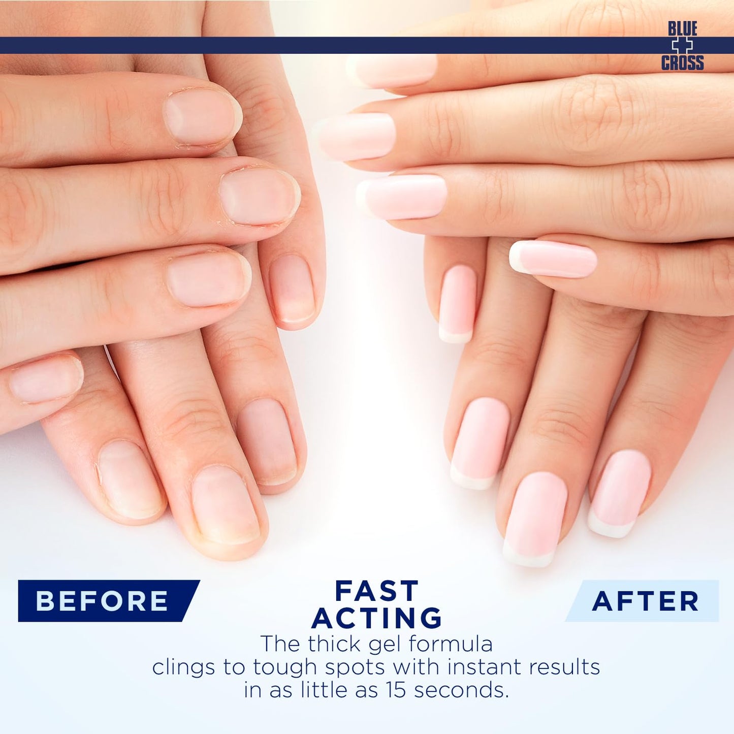 Cuticle Remover Liquid Gel - Hydrating Softener for Brittle Nails | 8oz Citrus