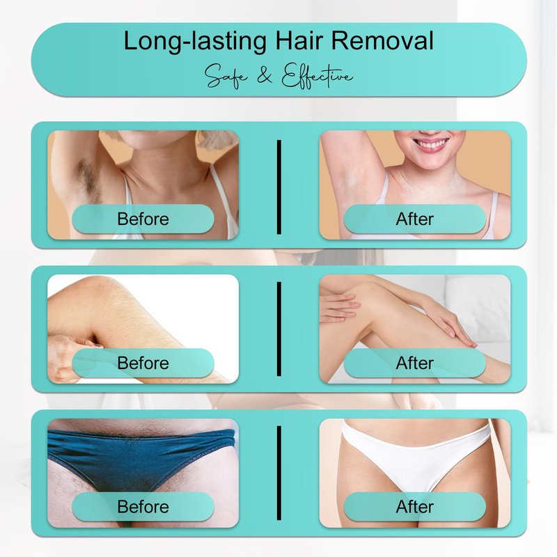 Pure Glide IPL Hair Removal Device for Women & Men, At-Home Hair Removal for Face, Legs, Arms & Bikini Line, Long-Lasting Hair Reduction, 999,999 Flashes, Painless & Easy to Use